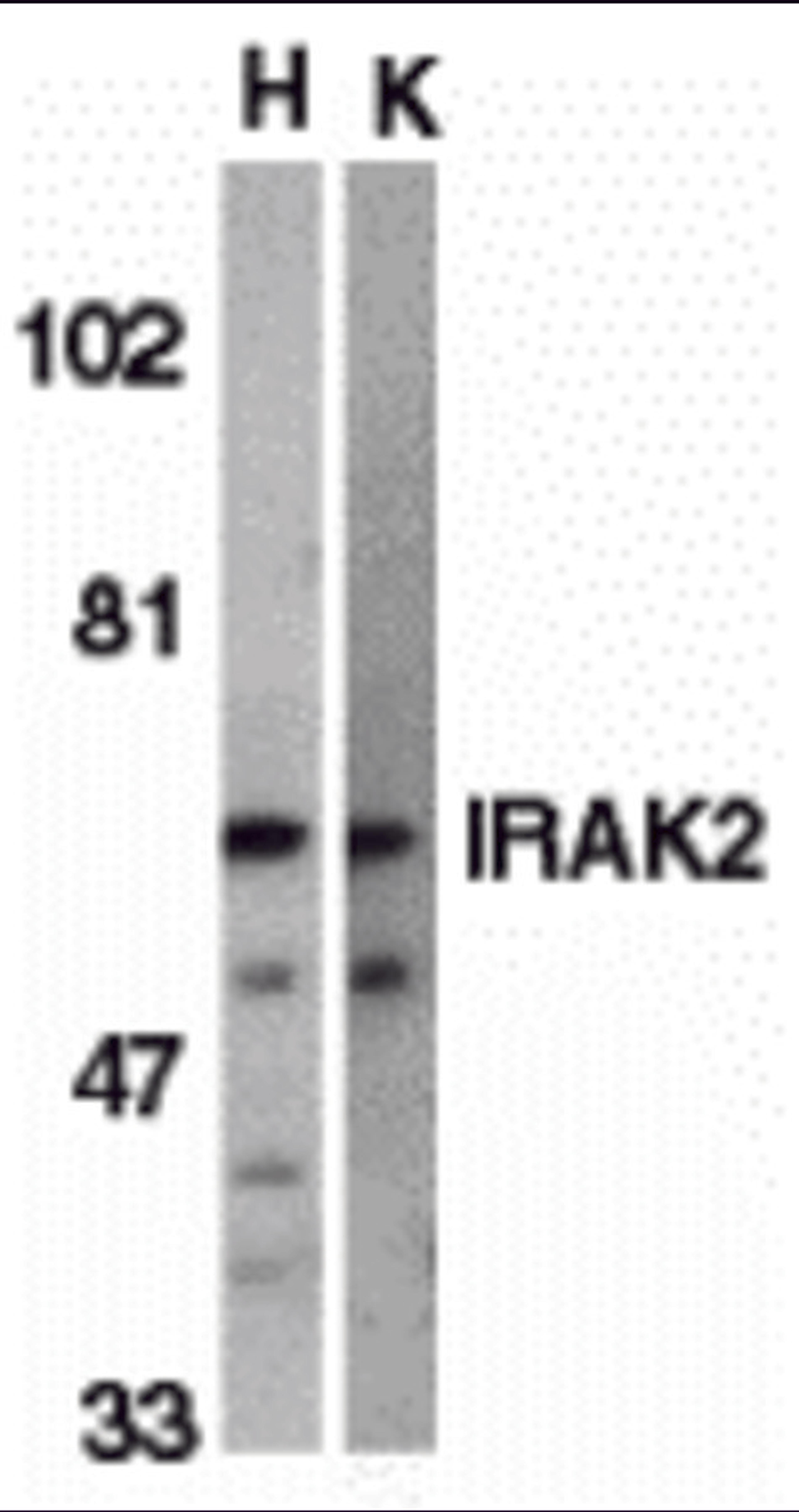 Western blot analysis of IRAK2 in HeLa (H) and K562 (K) whole cell lysate with IRAK2 antibody (C2) at 2 μg/mL.