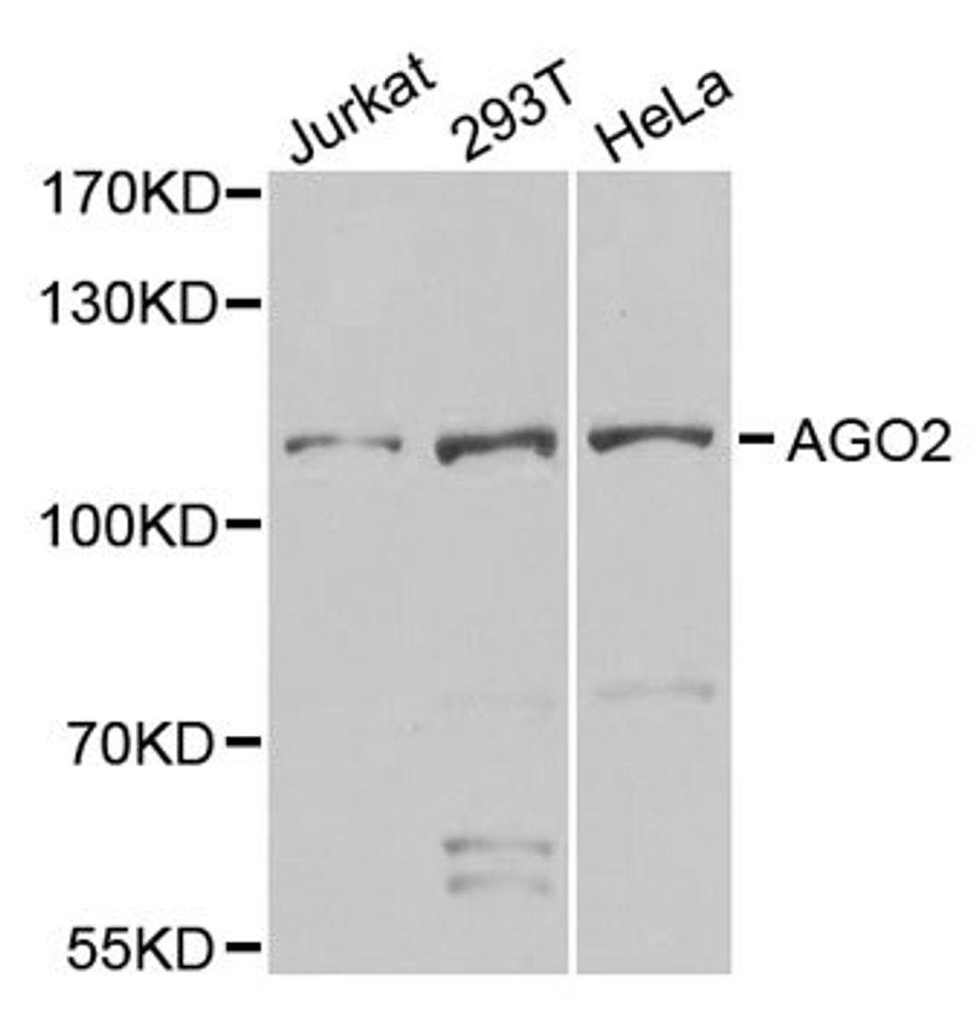 Western blot - Argonaute-2 antibody (A6802)