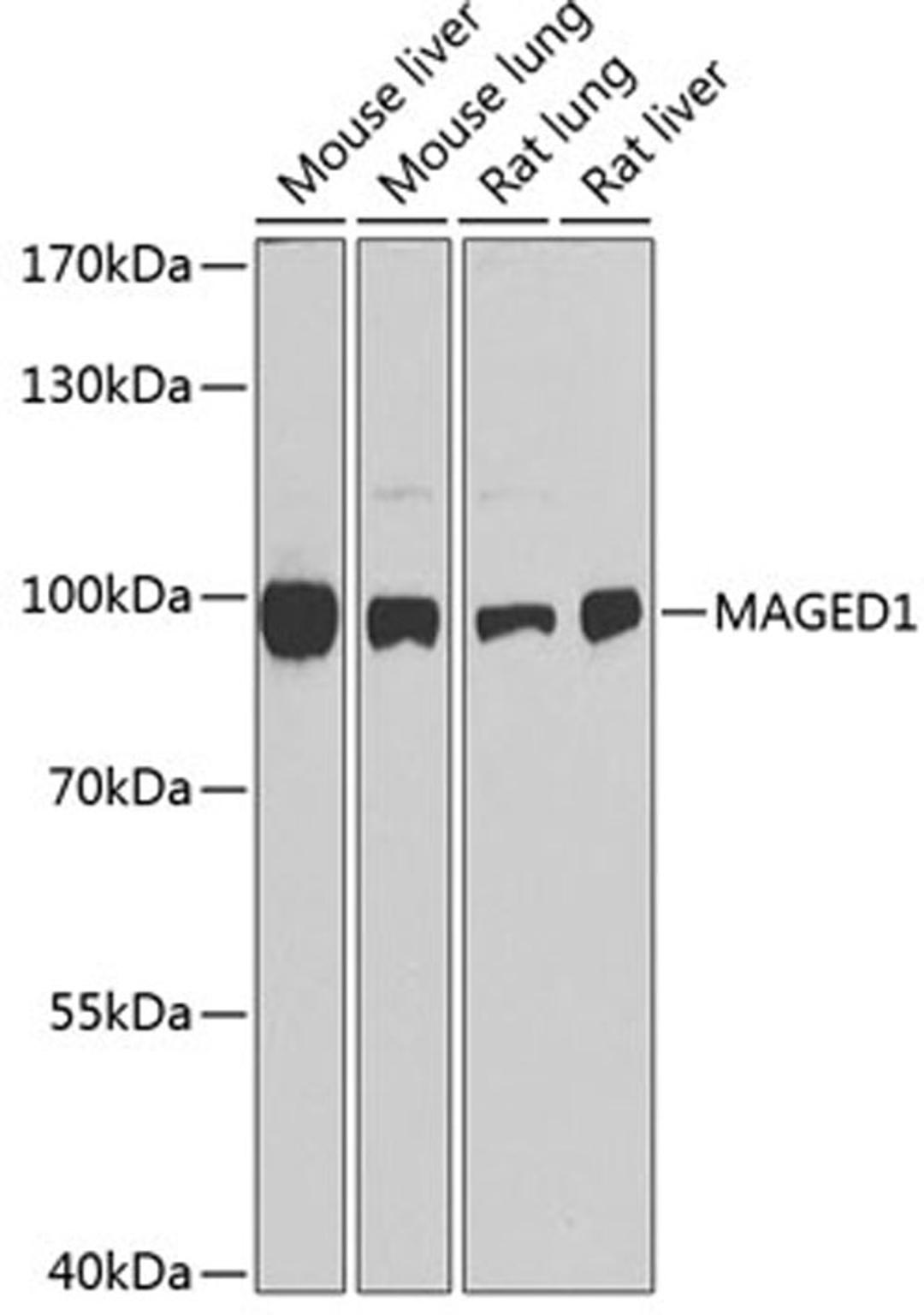 Western blot - MAGED1 antibody (A1092)