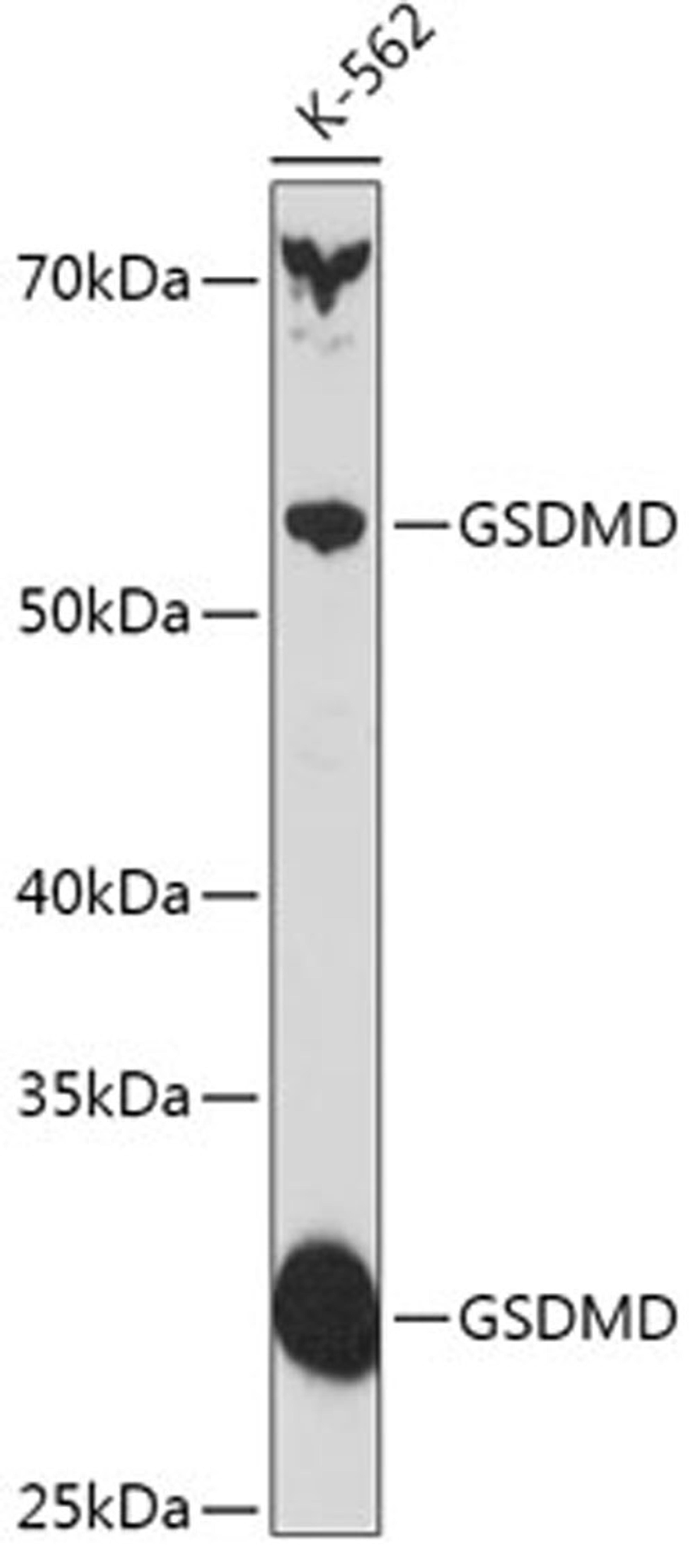 Western blot - GSDMD antibody (A18281)