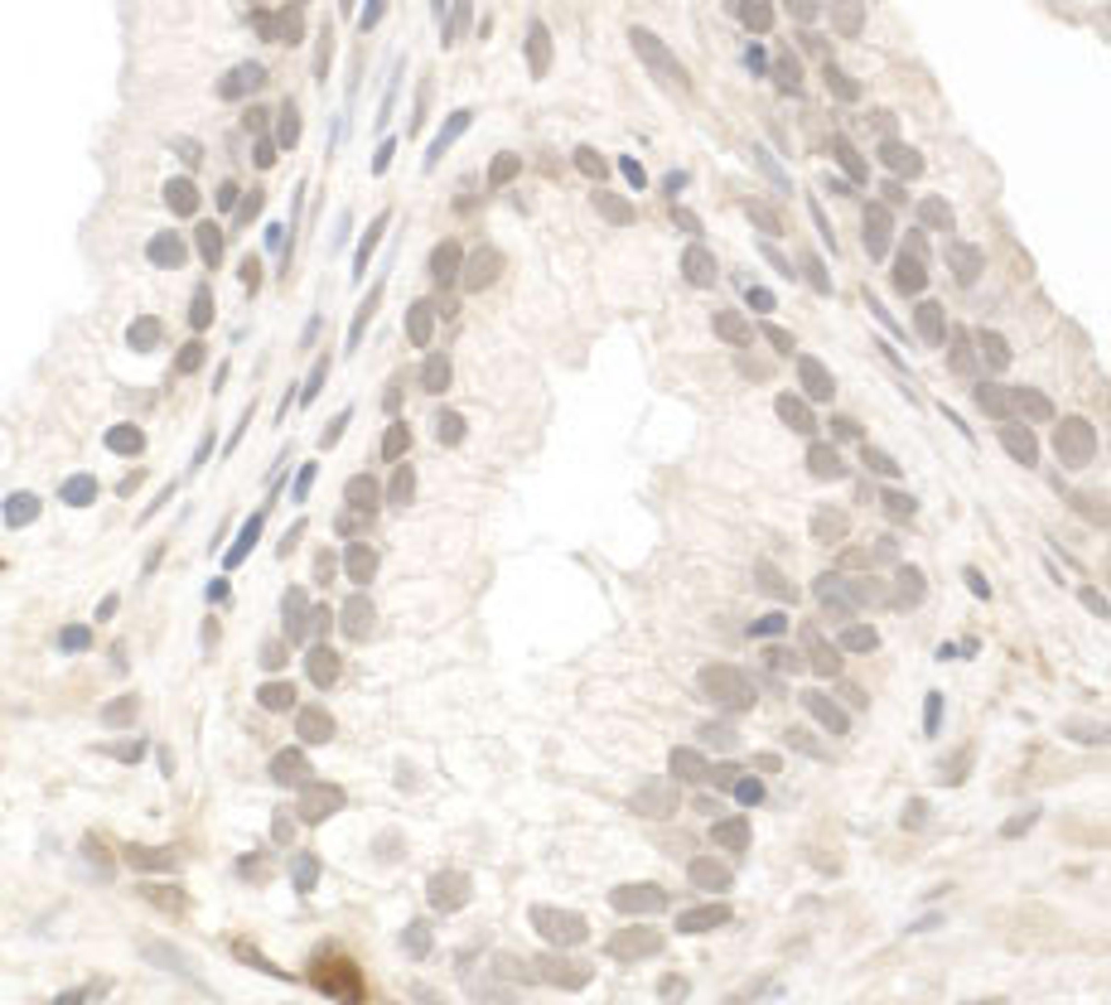 Detection of human PIMT by immunohistochemistry.