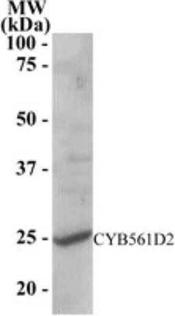 Western Blot: CYB561D2 Antibody [NB300-913] - Staining of human liver lysate (RIPA buffer, 35 ug total protein per lane). Primary antibody (1 ug/ml) incubated for 1 hour. Detected by western blot using chemiluminescence.