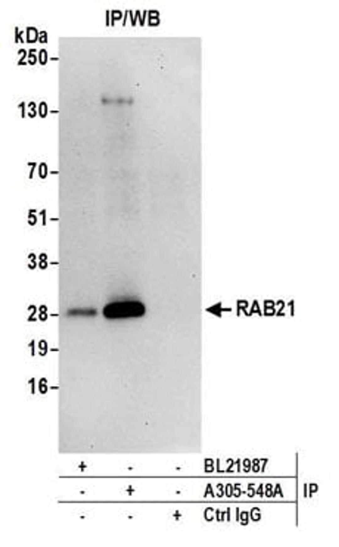 Detection of human RAB21 by western blot of immunoprecipitates.