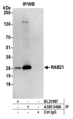 Detection of human RAB21 by western blot of immunoprecipitates.