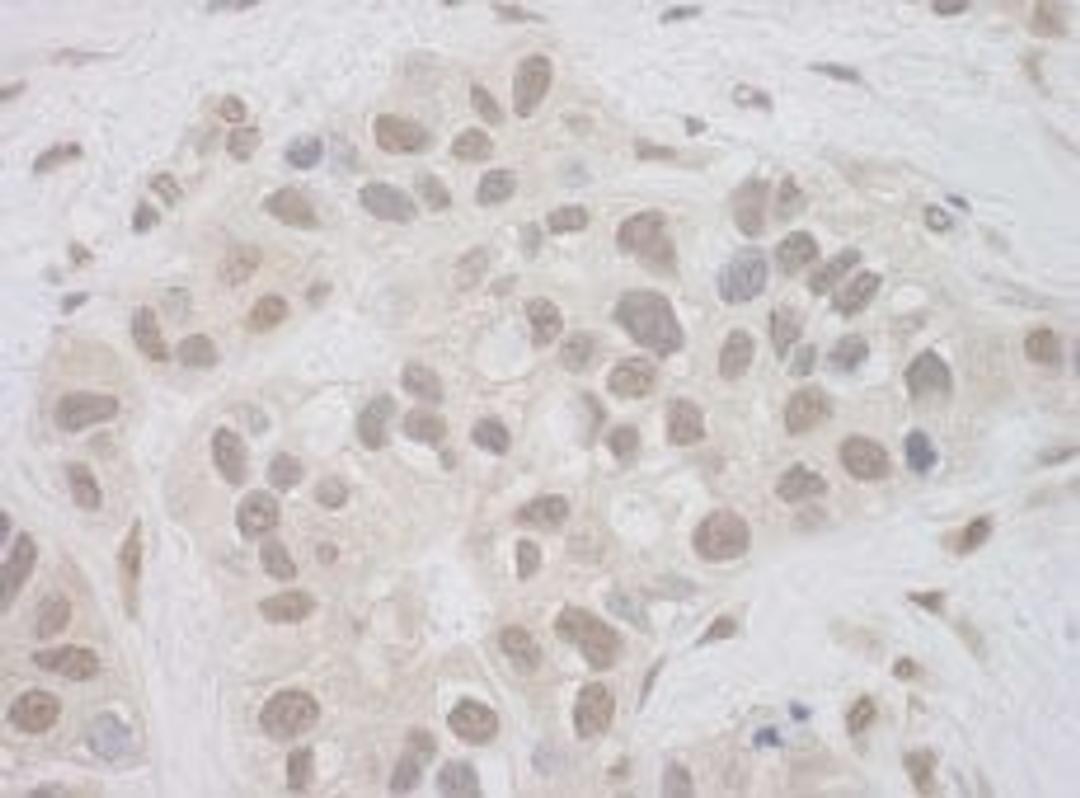 Detection of human SUPT7L by immunohistochemistry.