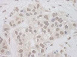 Detection of human SUPT7L by immunohistochemistry.