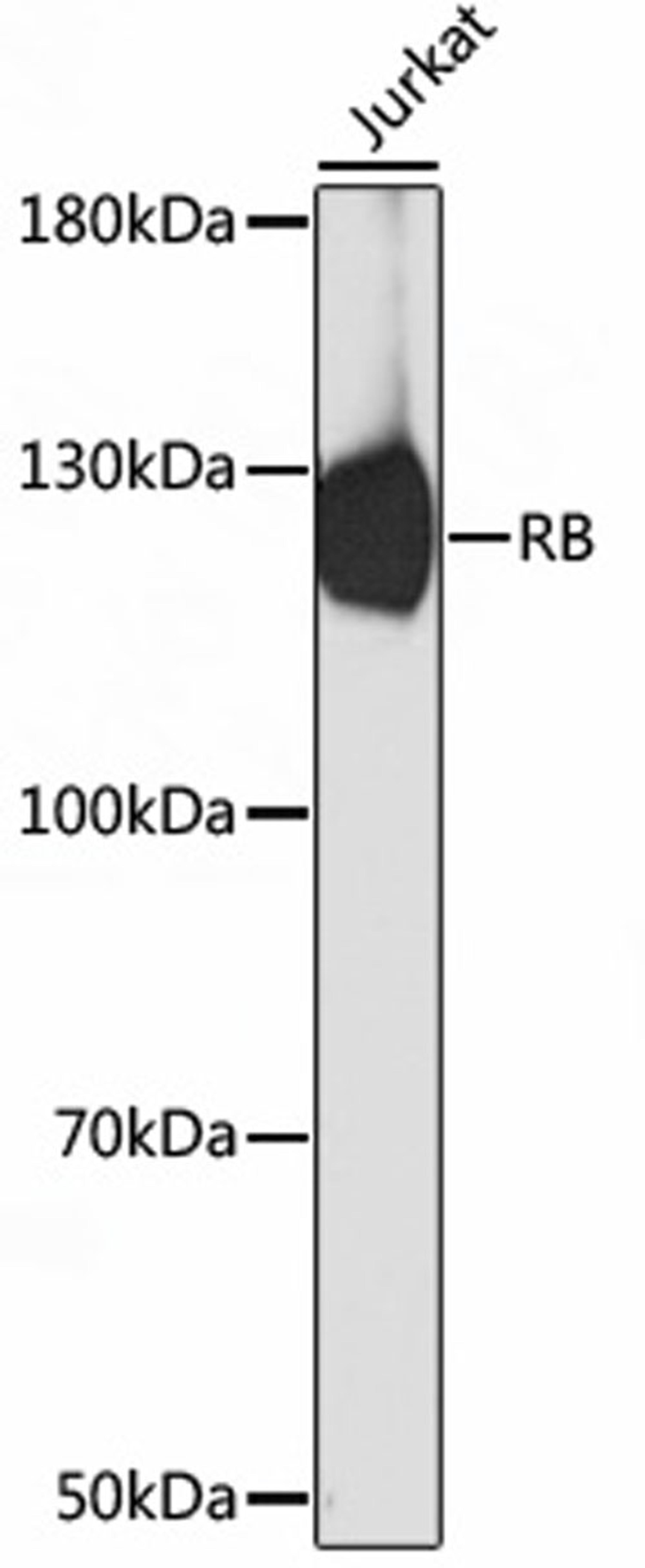 Western blot - Rb antibody (A17005)