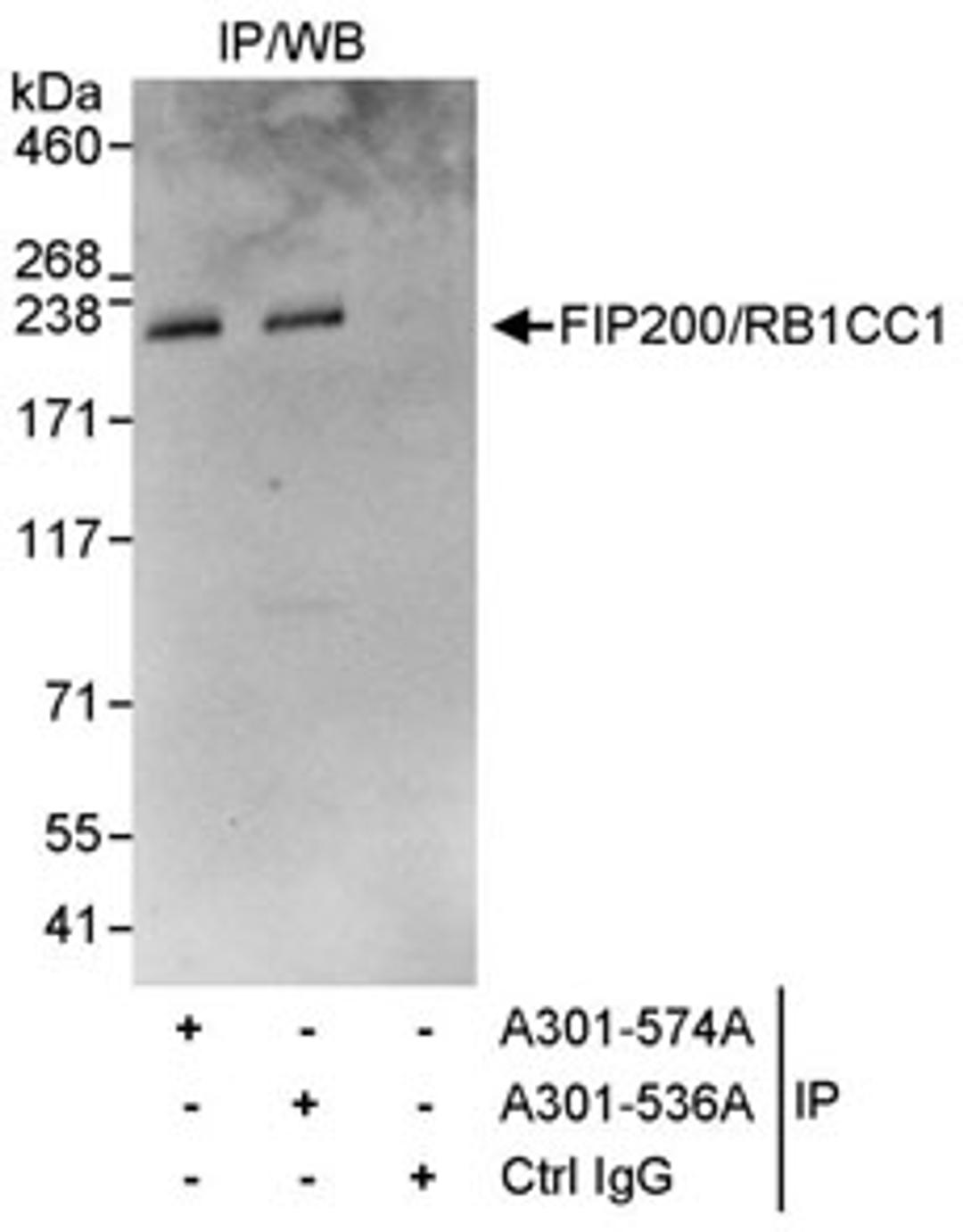 Detection of human FIP200/RB1CC1 by western blot of immunoprecipitates.