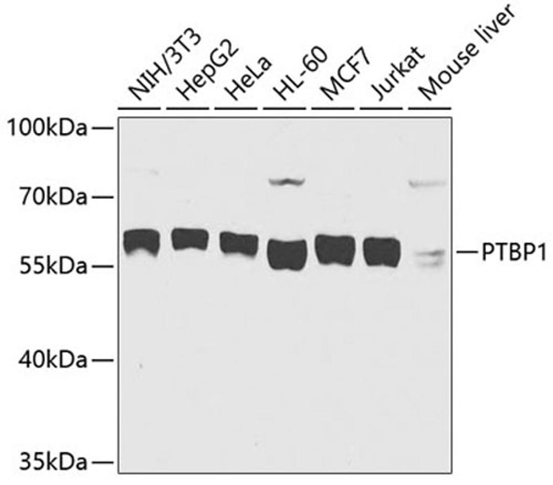 Western blot - PTBP1 antibody (A6107)