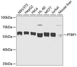 Western blot - PTBP1 antibody (A6107)