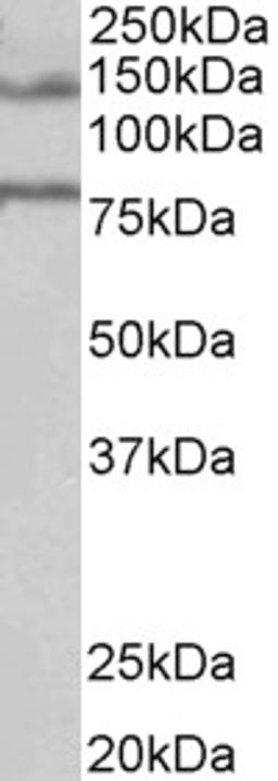 45-516 (1ug/ml) staining of Human Brain (Hippocampus) lysate (35ug protein in RIPA buffer). Primary incubation was 1 hour. Detected by chemiluminescence.