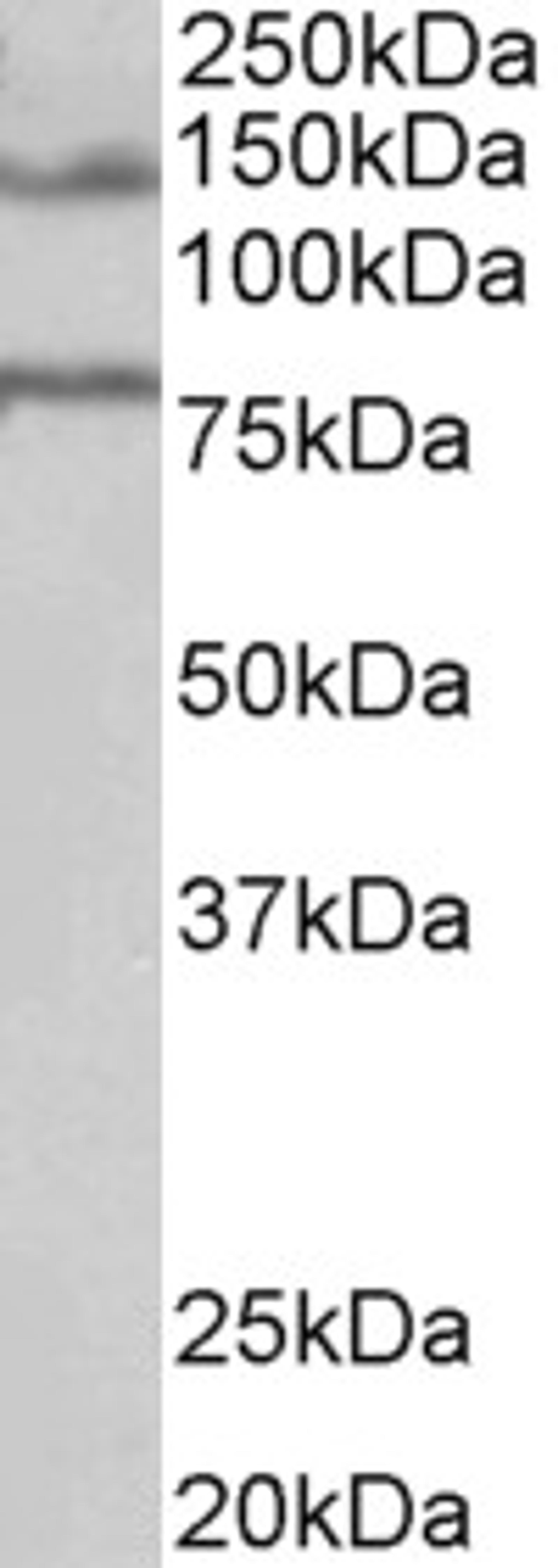 45-516 (1ug/ml) staining of Human Brain (Hippocampus) lysate (35ug protein in RIPA buffer). Primary incubation was 1 hour. Detected by chemiluminescence.