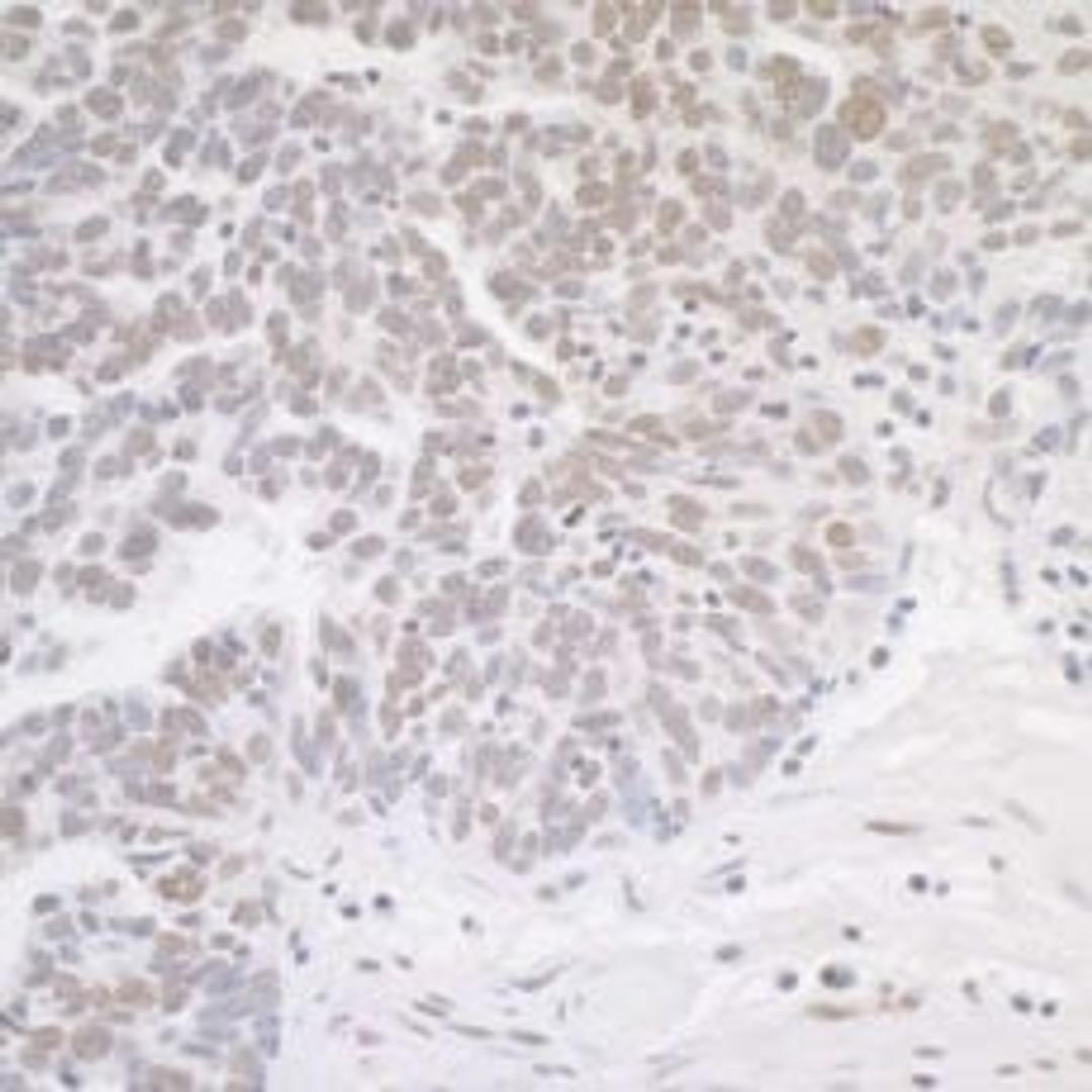 Detection of human MED12 by immunohistochemistry.