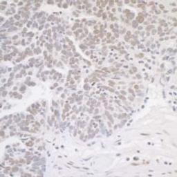 Detection of human MED12 by immunohistochemistry.