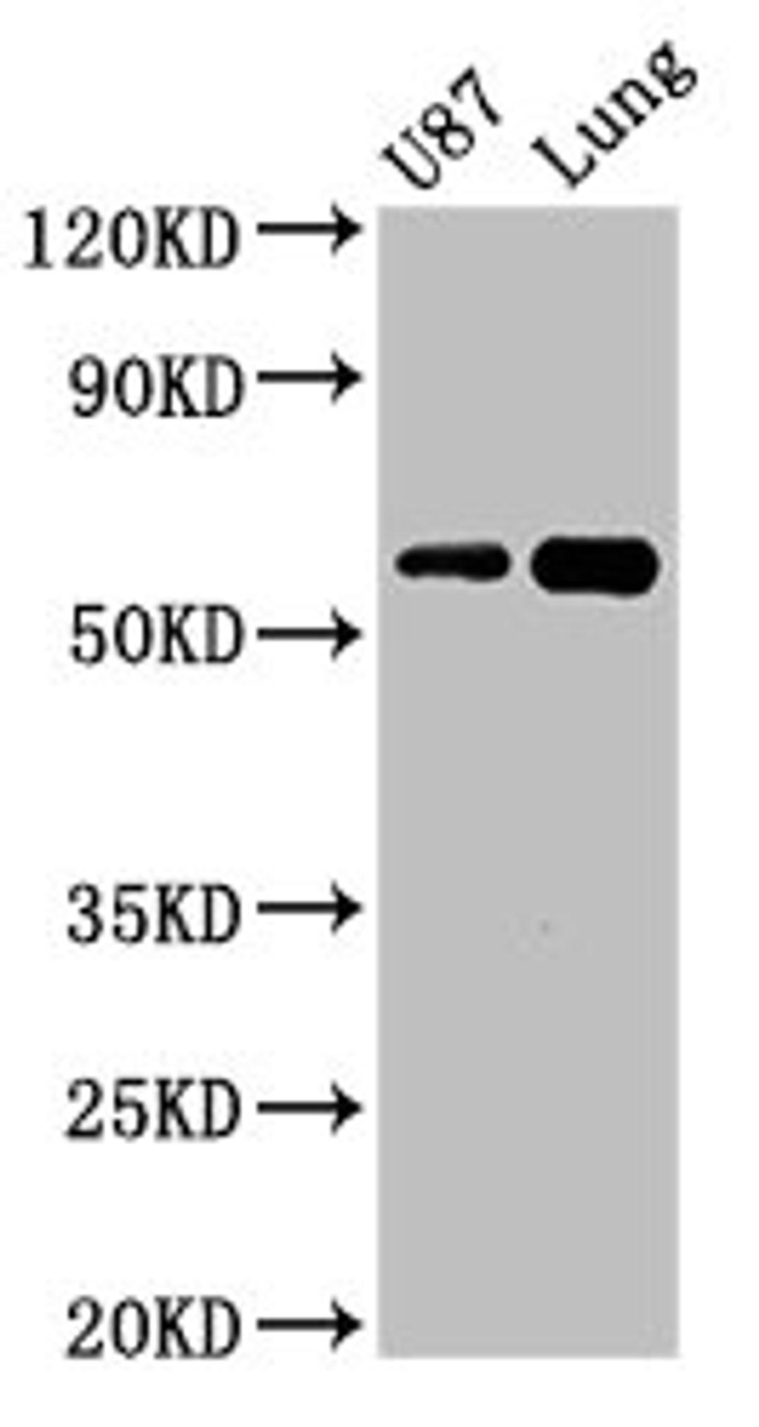 Western Blot. Positive WB detected in: U87 whole cell lysate, Mouse lung tissue. All lanes: SHC3 antibody at 3ug/ml. Secondary. Goat polyclonal to rabbit IgG at 1/50000 dilution. Predicted band size: 65, 52 kDa. Observed band size: 65 kDa. 