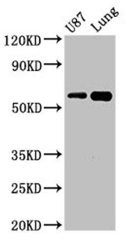 Western Blot. Positive WB detected in: U87 whole cell lysate, Mouse lung tissue. All lanes: SHC3 antibody at 3ug/ml. Secondary. Goat polyclonal to rabbit IgG at 1/50000 dilution. Predicted band size: 65, 52 kDa. Observed band size: 65 kDa. 