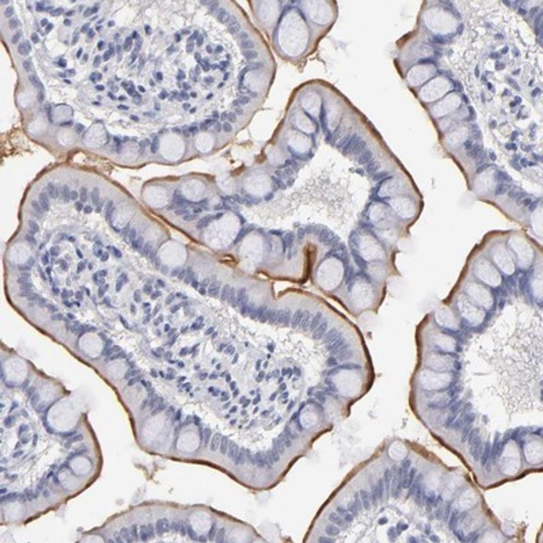 Immunohistochemistry-Paraffin: TEX11 Antibody [NBP1-80692] - Immunohistochemical staining of human small intestine shows strong membranous positivity in glandular cells.