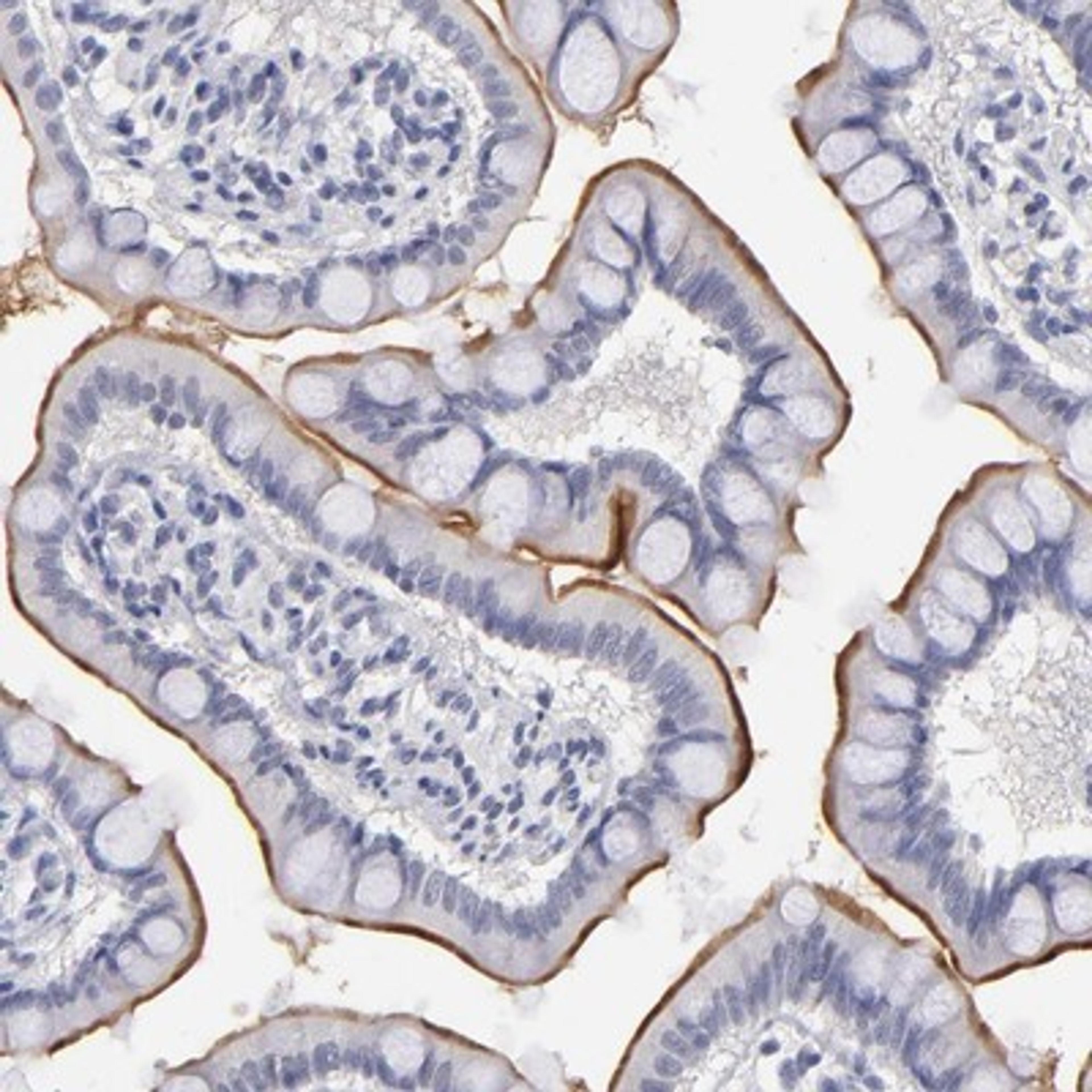 Immunohistochemistry-Paraffin: TEX11 Antibody [NBP1-80692] - Immunohistochemical staining of human small intestine shows strong membranous positivity in glandular cells.