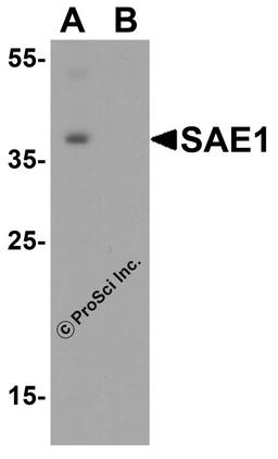 Western blot analysis of SAE1 in SK-N-SH lysate with SAE1 antibody at 0.5 μg/mL in (A) the absence and (B) the presence of blocking peptide.