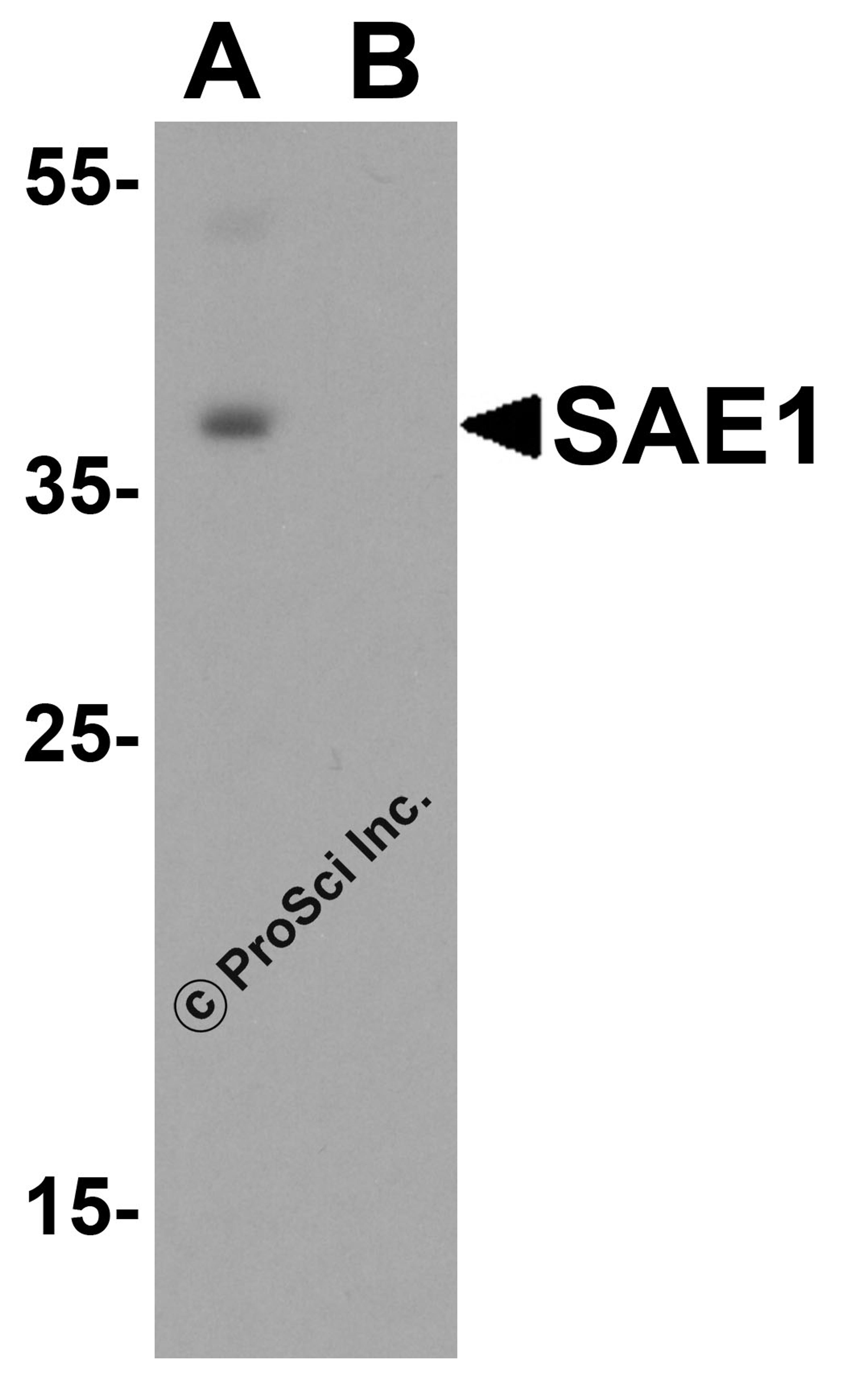 Western blot analysis of SAE1 in SK-N-SH lysate with SAE1 antibody at 0.5 μg/mL in (A) the absence and (B) the presence of blocking peptide.