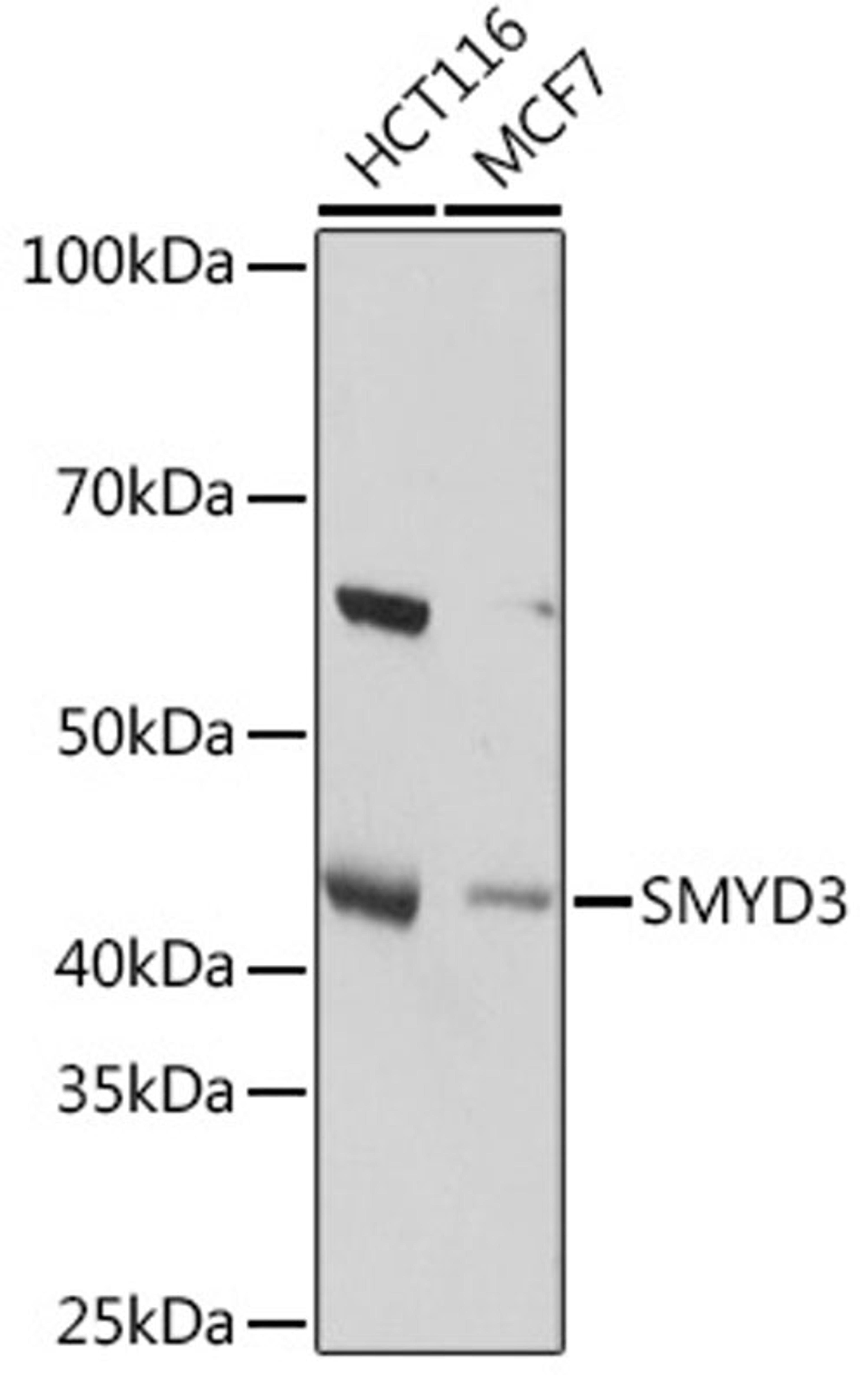 Western blot - SMYD3 Rabbit mAb (A2262)