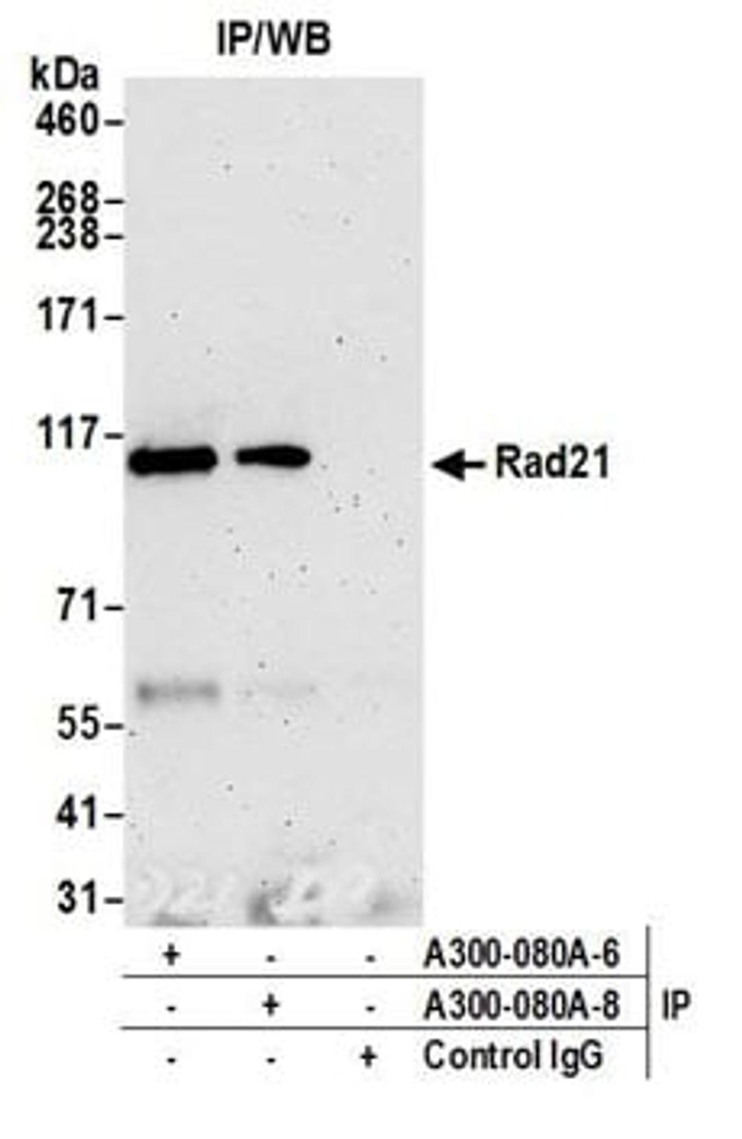 Detection of human Rad21 by western blot of immunoprecipitates.