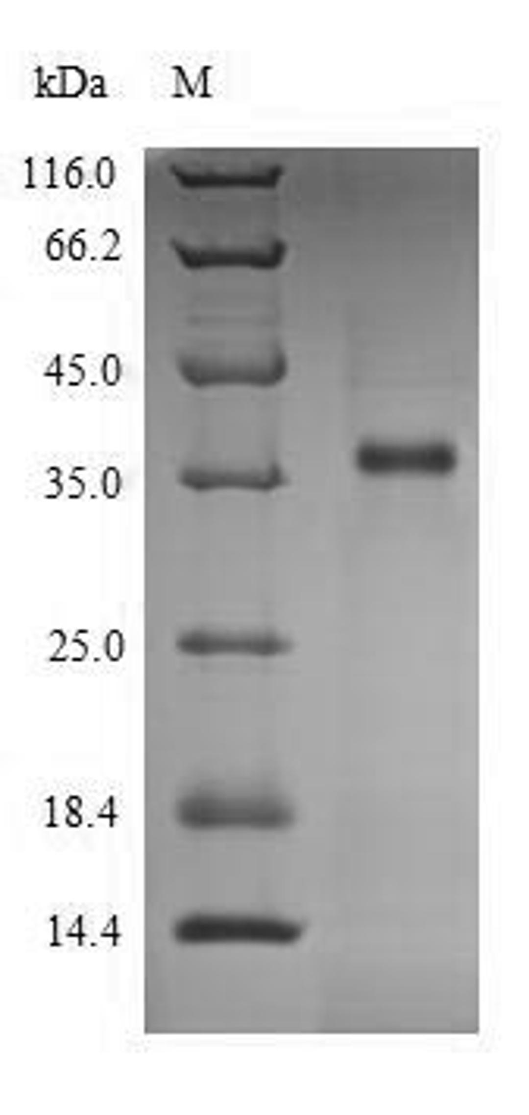 (Tris-Glycine gel) Discontinuous SDS-PAGE (reduced) with 5% enrichment gel and 15% separation gel.