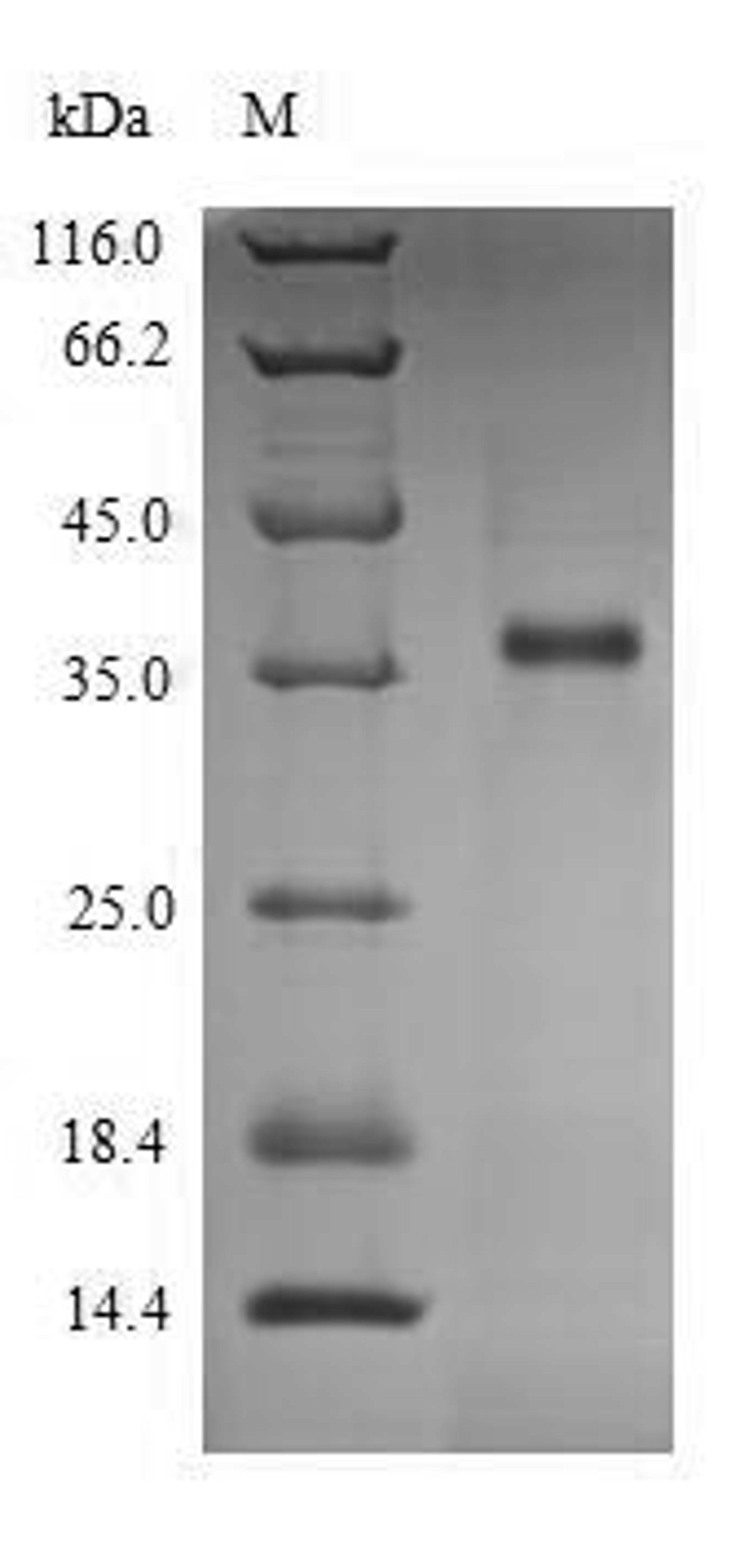 (Tris-Glycine gel) Discontinuous SDS-PAGE (reduced) with 5% enrichment gel and 15% separation gel.
