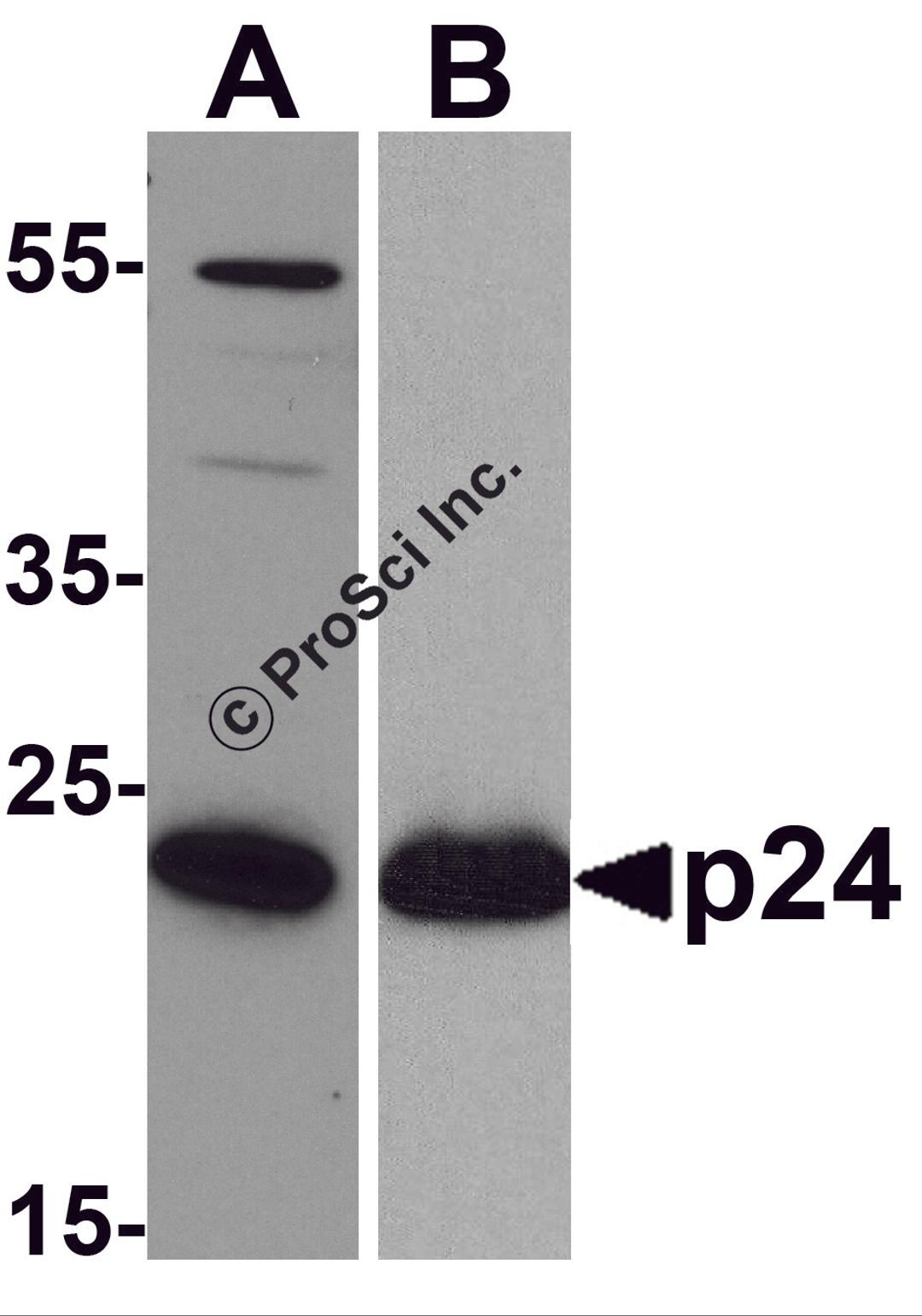 Western blot analysis of 20 ng of (A) viral p24 and (B) recombinant p24 with anti-HIV-1 p24 antibody PM-6585 at (A) 0.5 μg/mL and (B) 0.2 μg/mL, respectively.