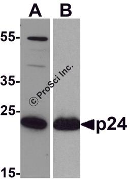 Western blot analysis of 20 ng of (A) viral p24 and (B) recombinant p24 with anti-HIV-1 p24 antibody PM-6585 at (A) 0.5 μg/mL and (B) 0.2 μg/mL, respectively.