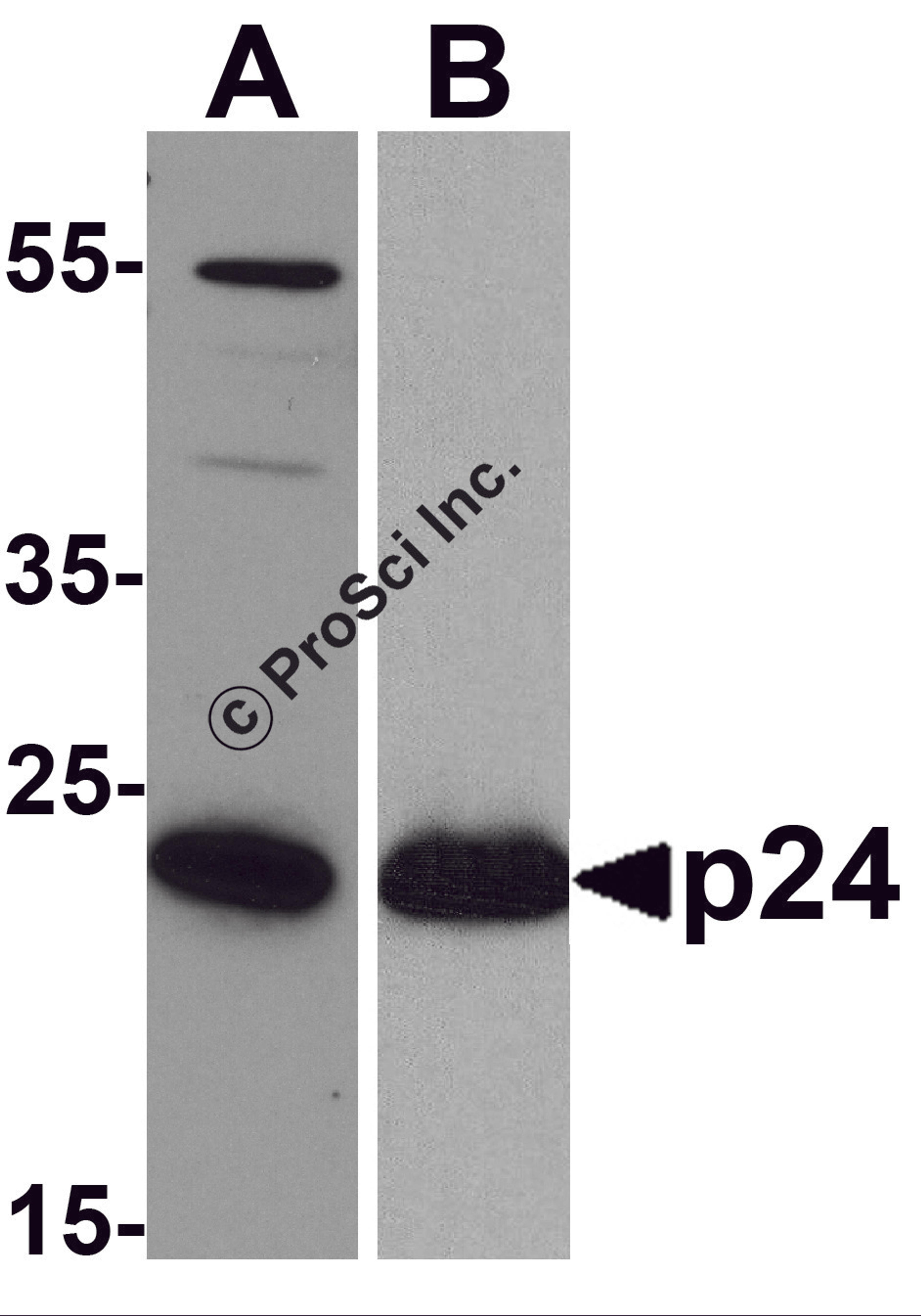 Western blot analysis of 20 ng of (A) viral p24 and (B) recombinant p24 with anti-HIV-1 p24 antibody PM-6585 at (A) 0.5 μg/mL and (B) 0.2 μg/mL, respectively.
