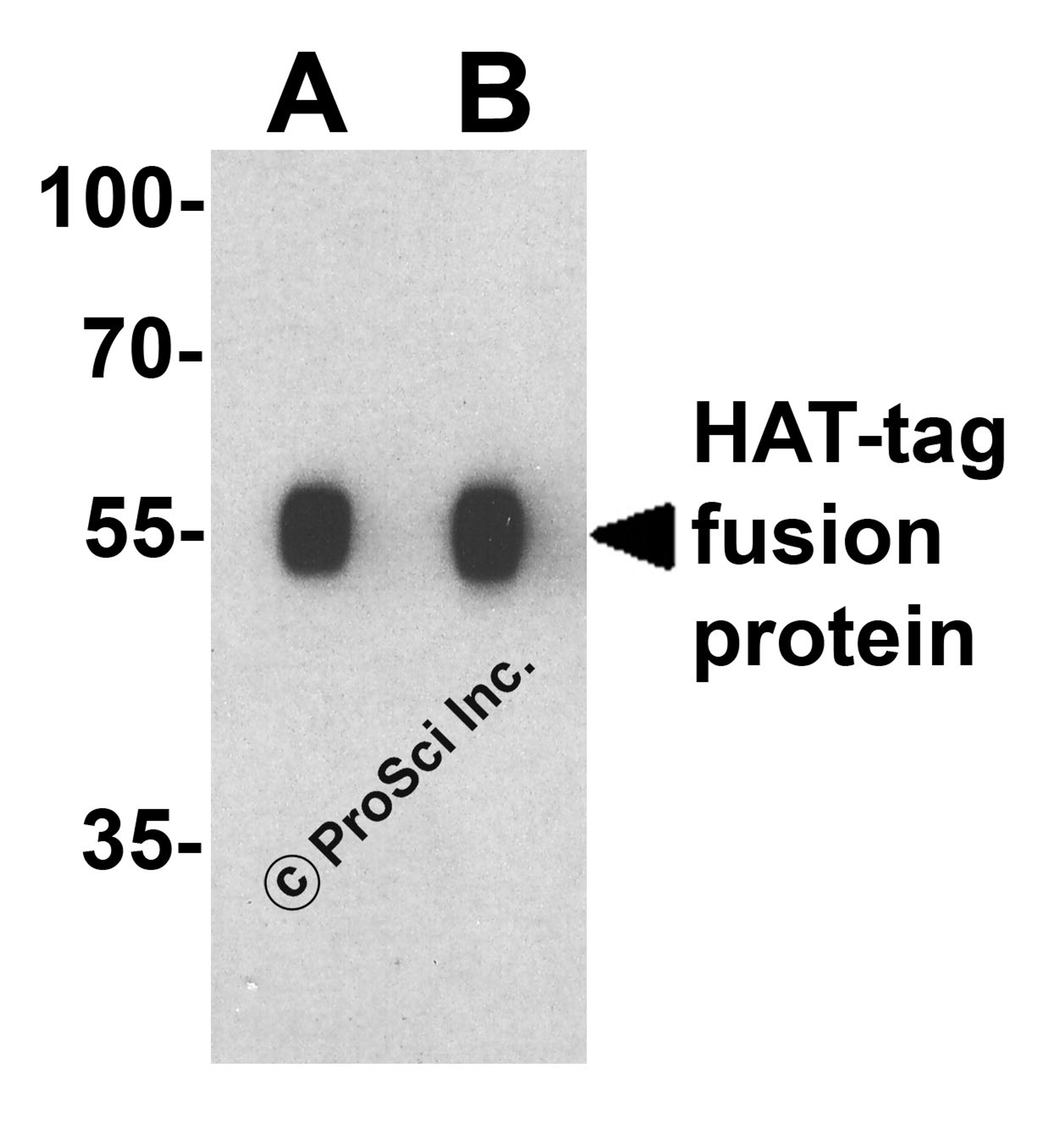 Western blot analysis of a HAT-tag-containing recombinant protein with HAT-tag antibody at (A) 0.125 and (B) 0.25 μg/ml.