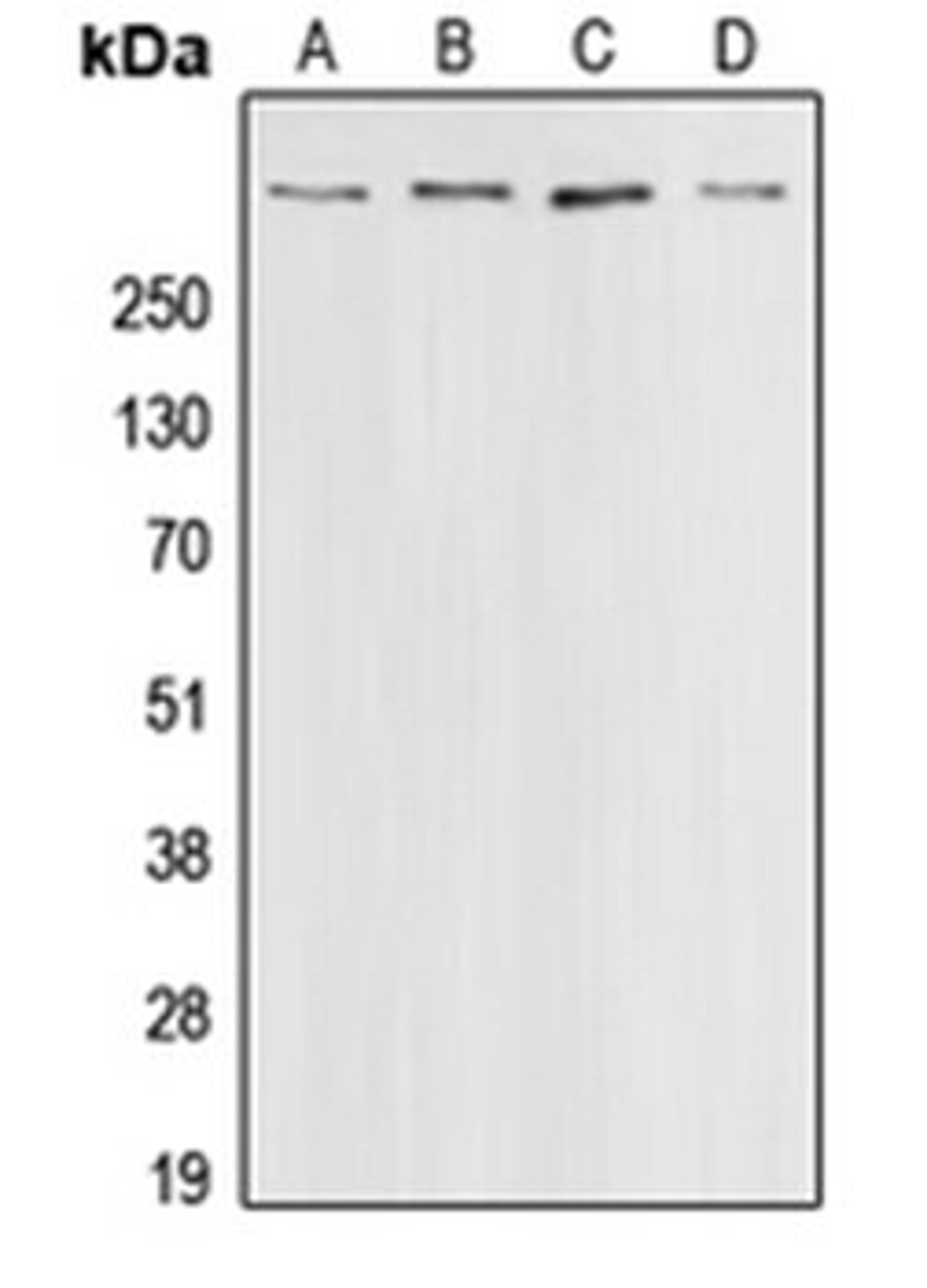 Western blot analysis of HeLa (Lane 1), A431 (Lane 2), HT29 (Lane 3), A549 (Lane 4) whole cell lysates using CREBBP antibody