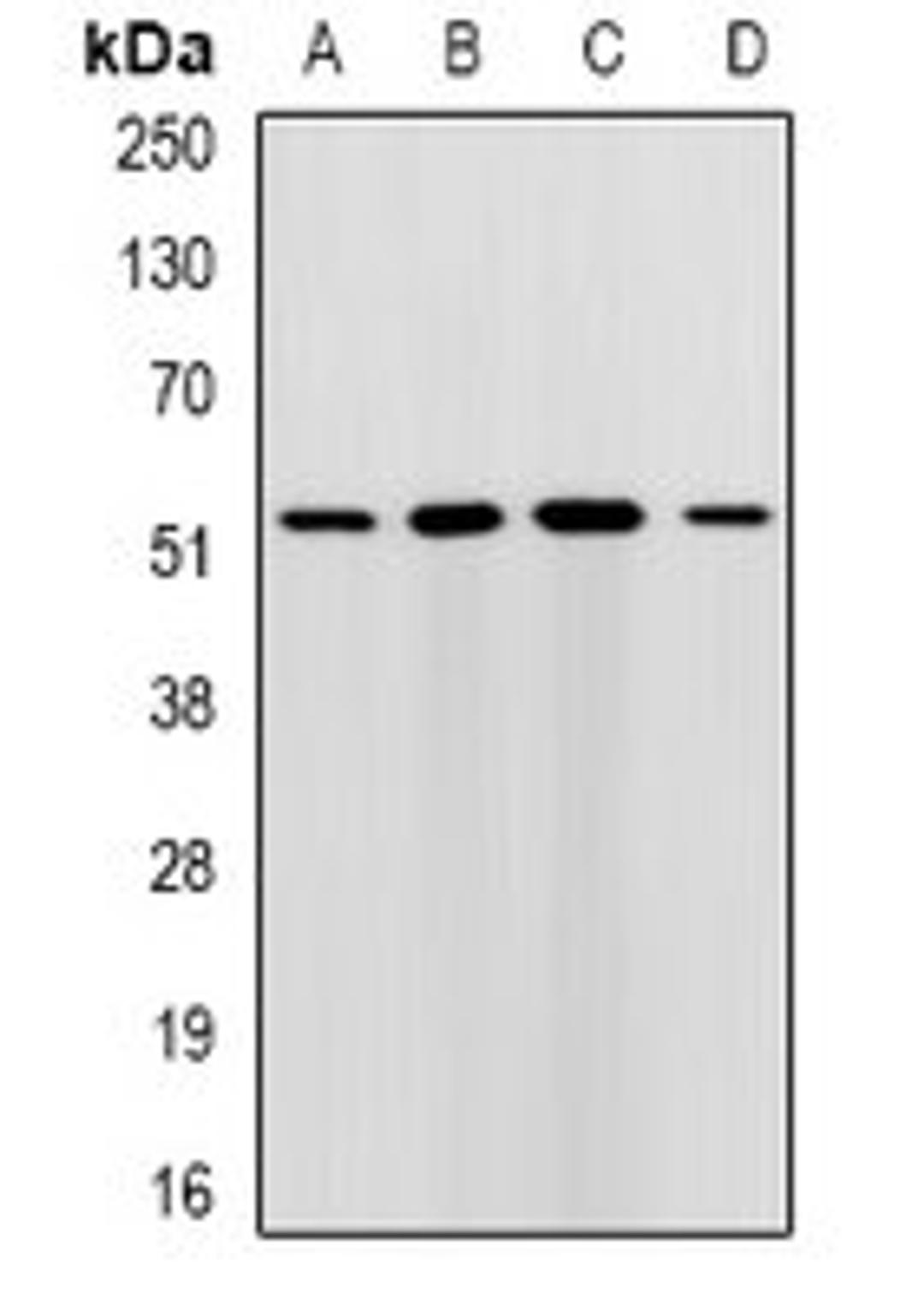 Western blot analysis of HepG2 (Lane1), MCF7 (Lane2), mouse liver (Lane3), mouse brain (Lane4) whole cell lysates using RMDN3 antibody