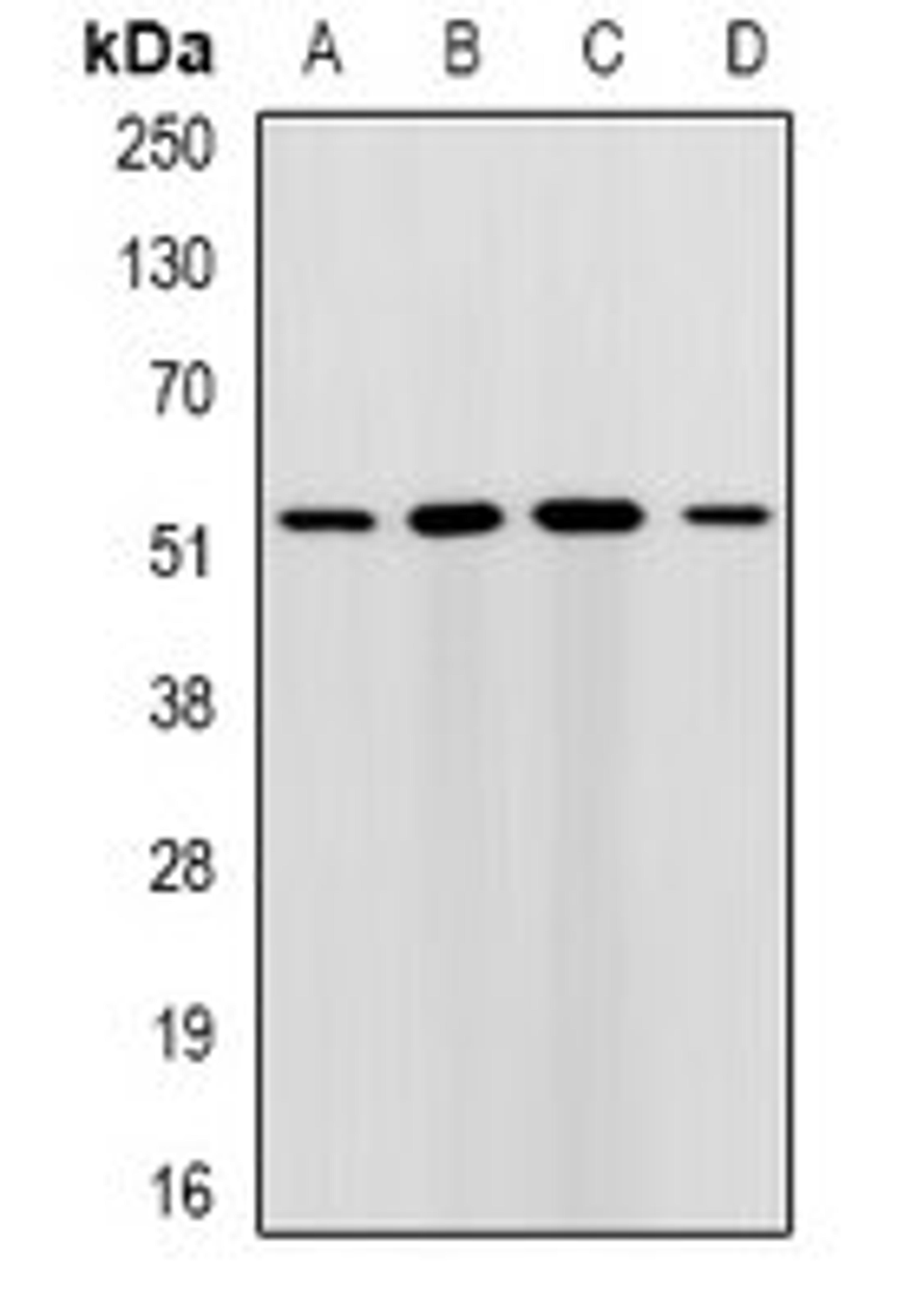 Western blot analysis of HepG2 (Lane1), MCF7 (Lane2), mouse liver (Lane3), mouse brain (Lane4) whole cell lysates using RMDN3 antibody