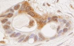 Detection of human OSR1 by immunohistochemistry.