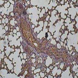 Immunohistochemical analysis of formalin-fixed paraffin embedded mouse lung tissue using Cathepsin D antibody.