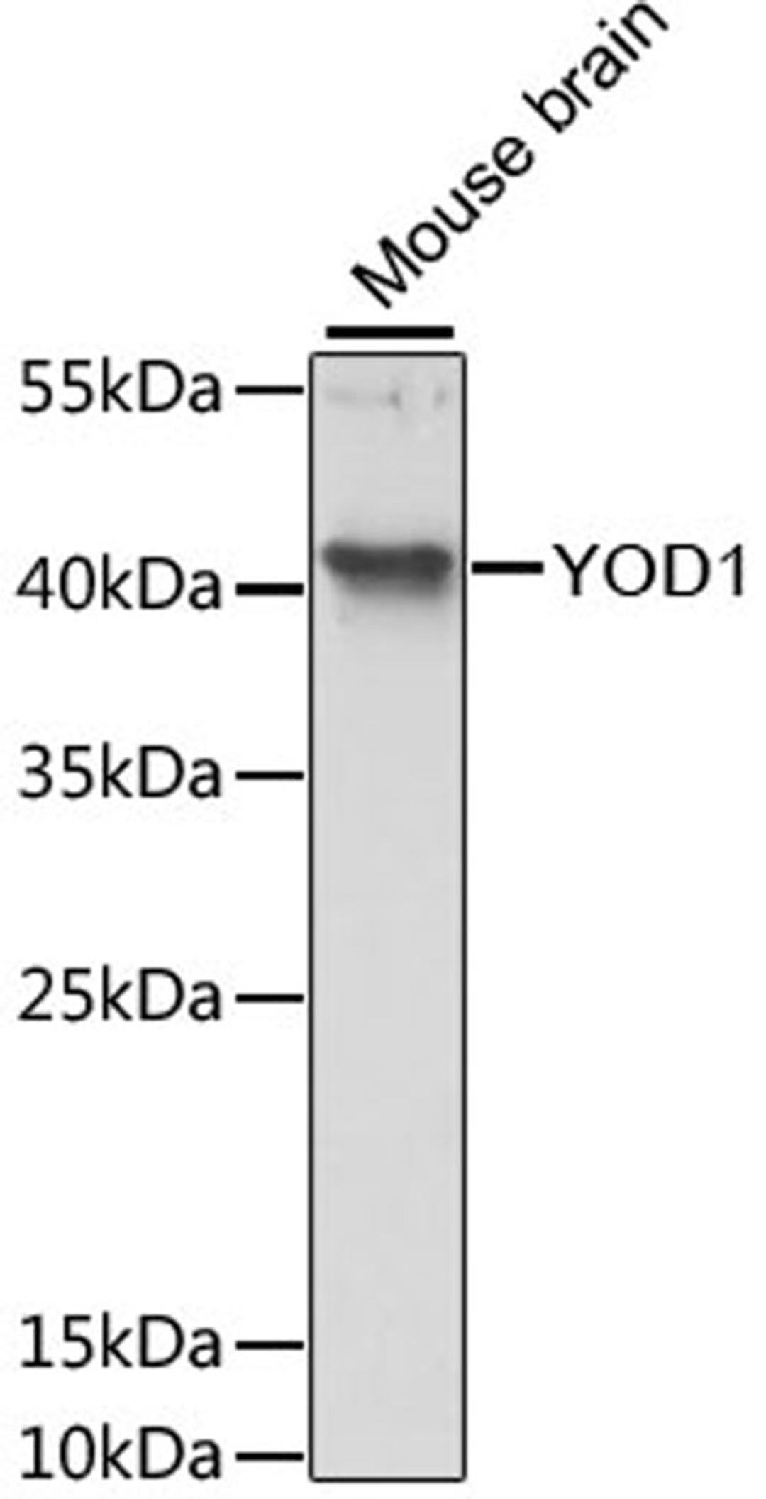 Western blot - YOD1 antibody (A13270)