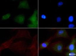 Immunocytochemistry/Immunofluorescence: NBR1 Antibody [NBP1-71703] - NBR1 antibody was tested at 1:50 in HeLa cells with FITC (green). Nuclei and actin were counterstained with Dapi (blue) and Phalloidin (red).