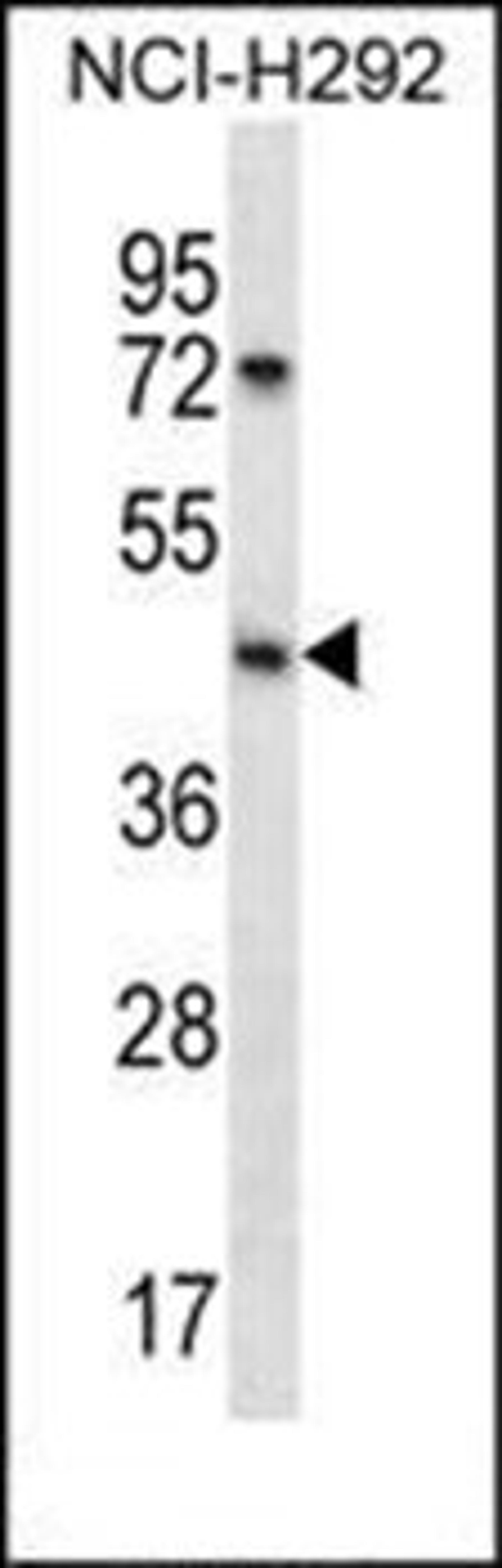 Western blot analysis of NCI-H292 cell line lysates (35ug/lane) using SGPP1 antibody (N-term)