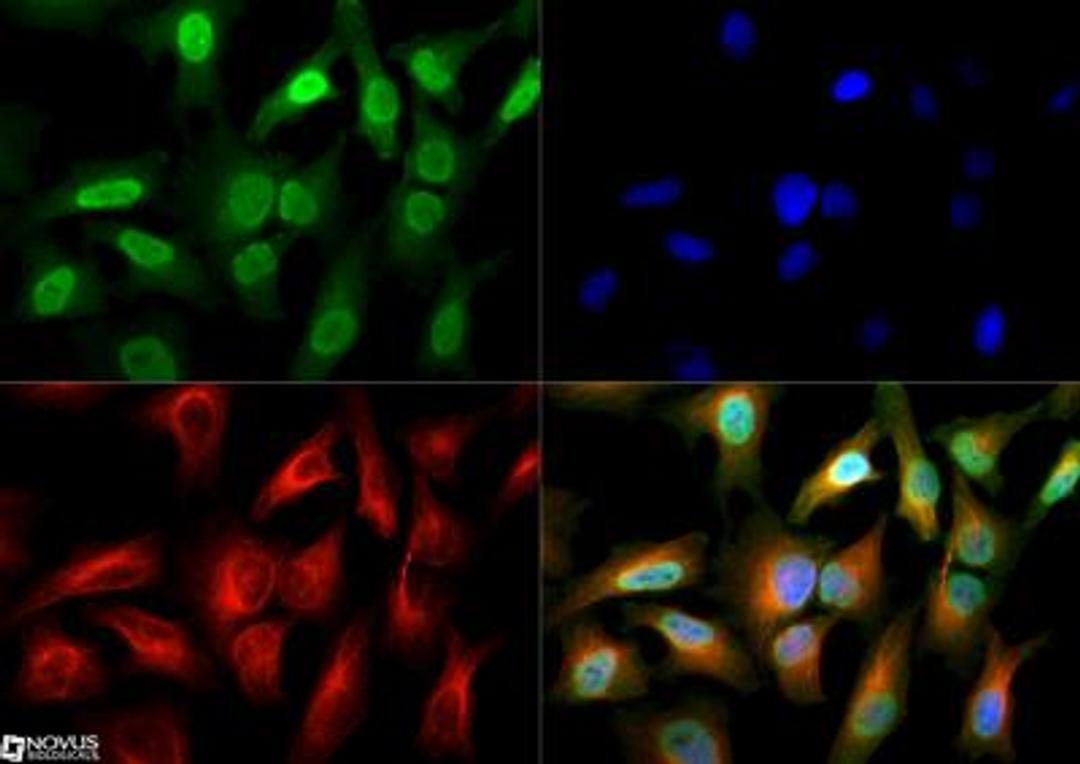 Immunocytochemistry/Immunofluorescence: Gli2 Antibody [NBP2-23602] - Gli2 antibody was tested in HeLa cells with DyLight 488 (green). Nuclei and alpha-tubulin were counterstained with DAPI (blue) and Dylight 550 (red). An antibody dilution of 1:50 was used. Image objective 40x.