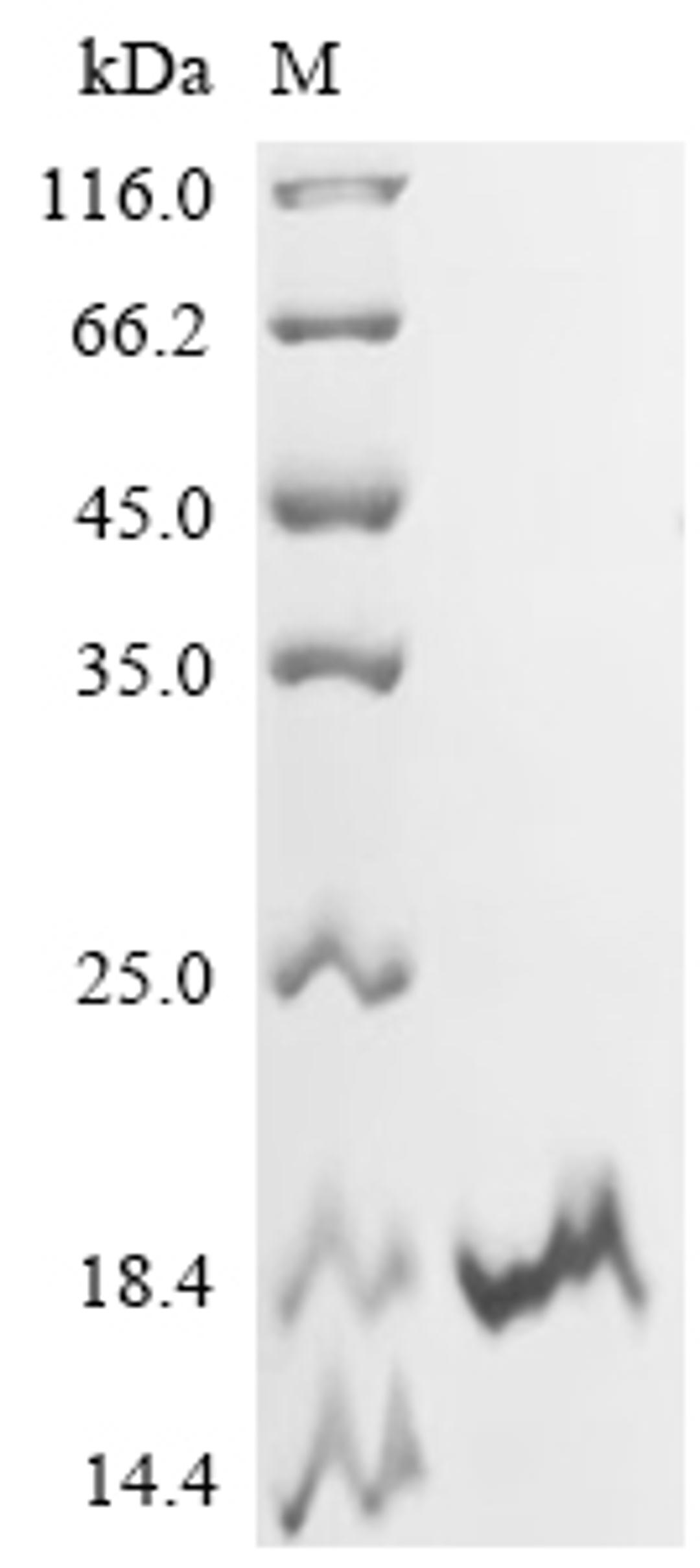 (Tris-Glycine gel) Discontinuous SDS-PAGE (reduced) with 5% enrichment gel and 15% separation gel.