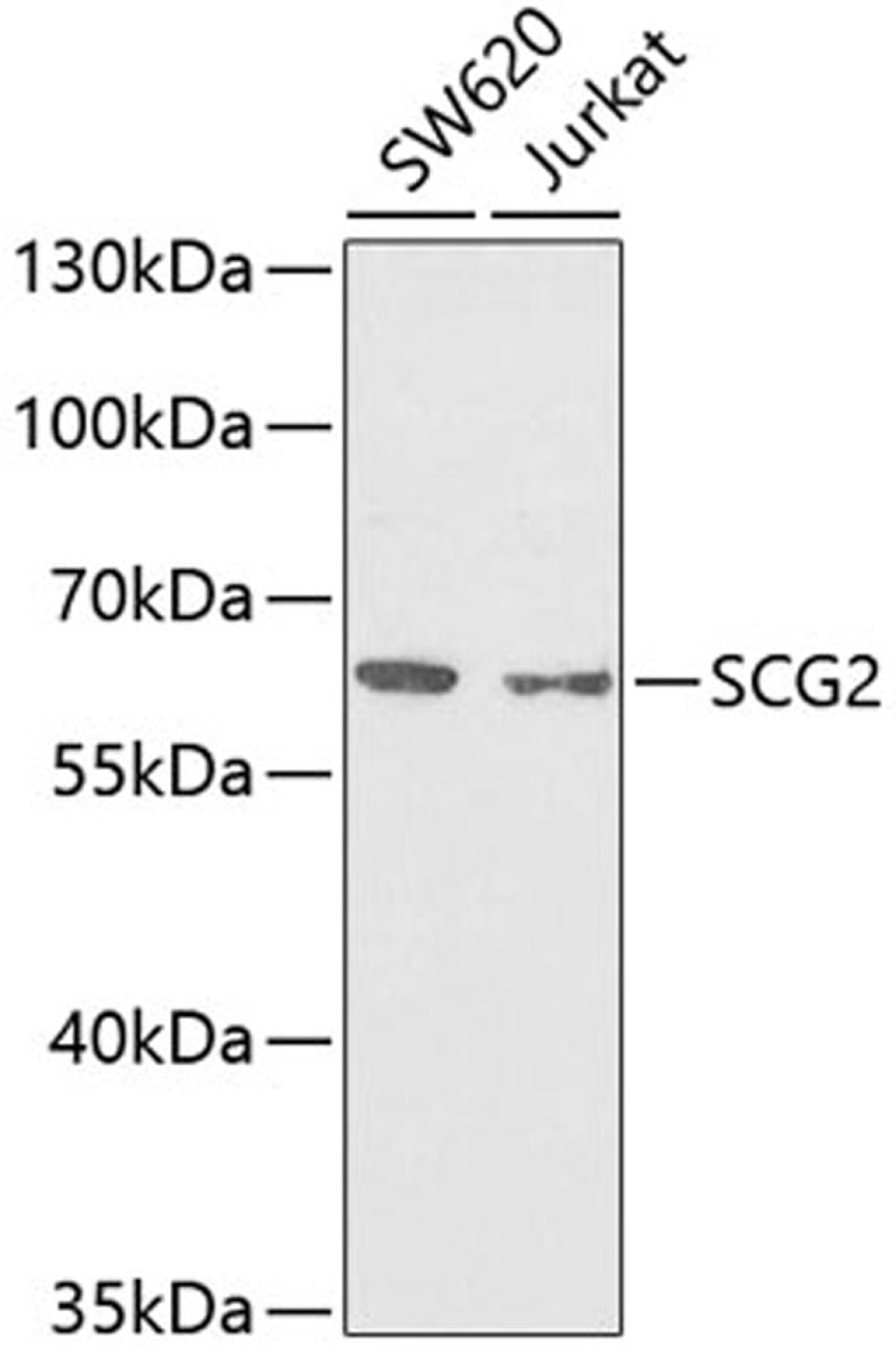 Western blot - SCG2 antibody (A6425)