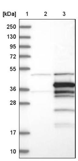 Western Blot: STX11 Antibody [NBP1-86122] - Lane 1: Marker [kDa] 250, 130, 95, 72, 55, 36, 28, 17, 10<br/>Lane 2: Negative control (vector only transfected HEK293T lysate)<br/>Lane 3: Over-expression lysate (Co-expressed with a C-terminal myc-DDK tag (~3.1 kDa) in mammalian HEK293T cells, LY401241)