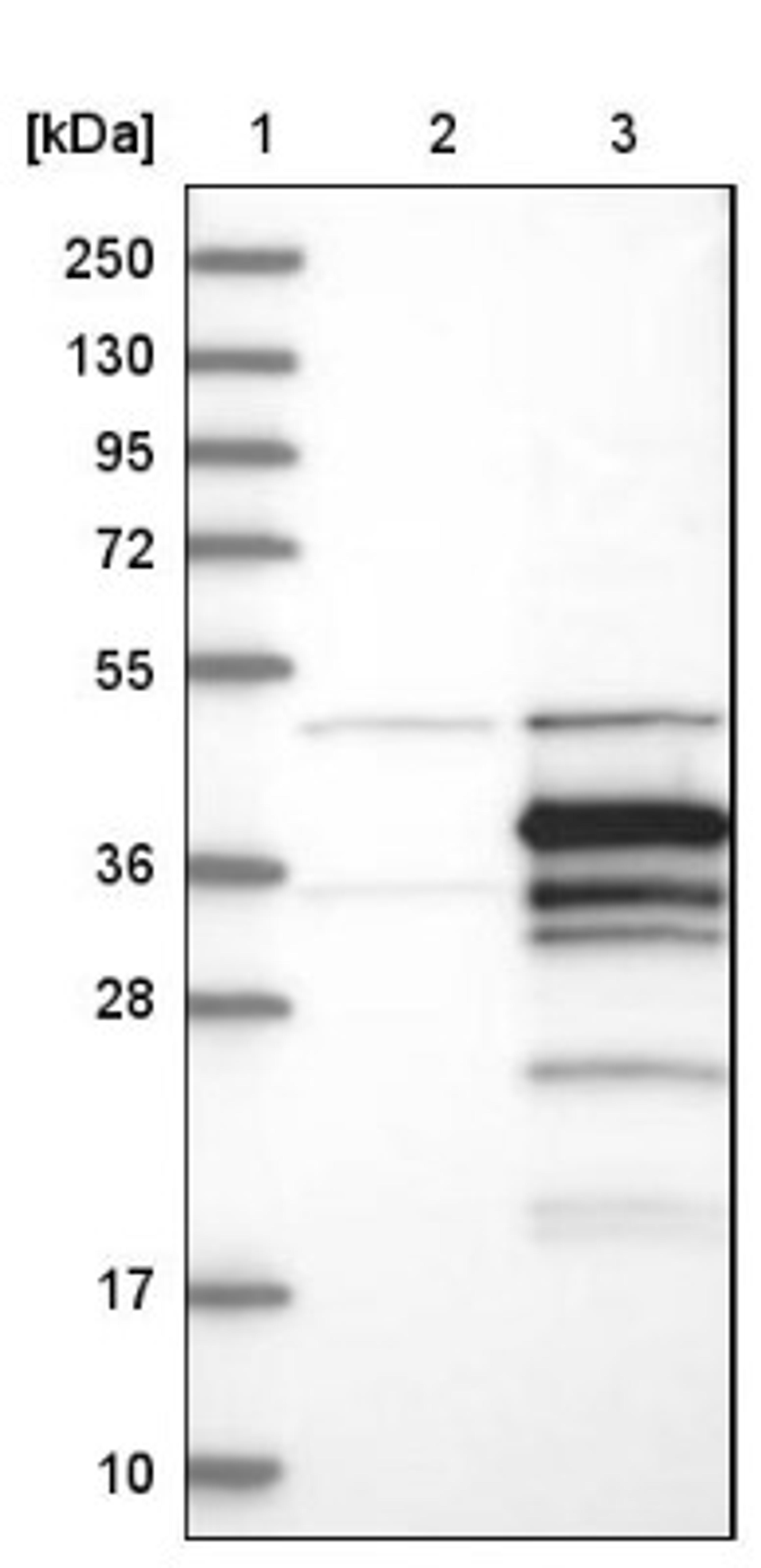 Western Blot: STX11 Antibody [NBP1-86122] - Lane 1: Marker [kDa] 250, 130, 95, 72, 55, 36, 28, 17, 10<br/>Lane 2: Negative control (vector only transfected HEK293T lysate)<br/>Lane 3: Over-expression lysate (Co-expressed with a C-terminal myc-DDK tag (~3.1 kDa) in mammalian HEK293T cells, LY401241)