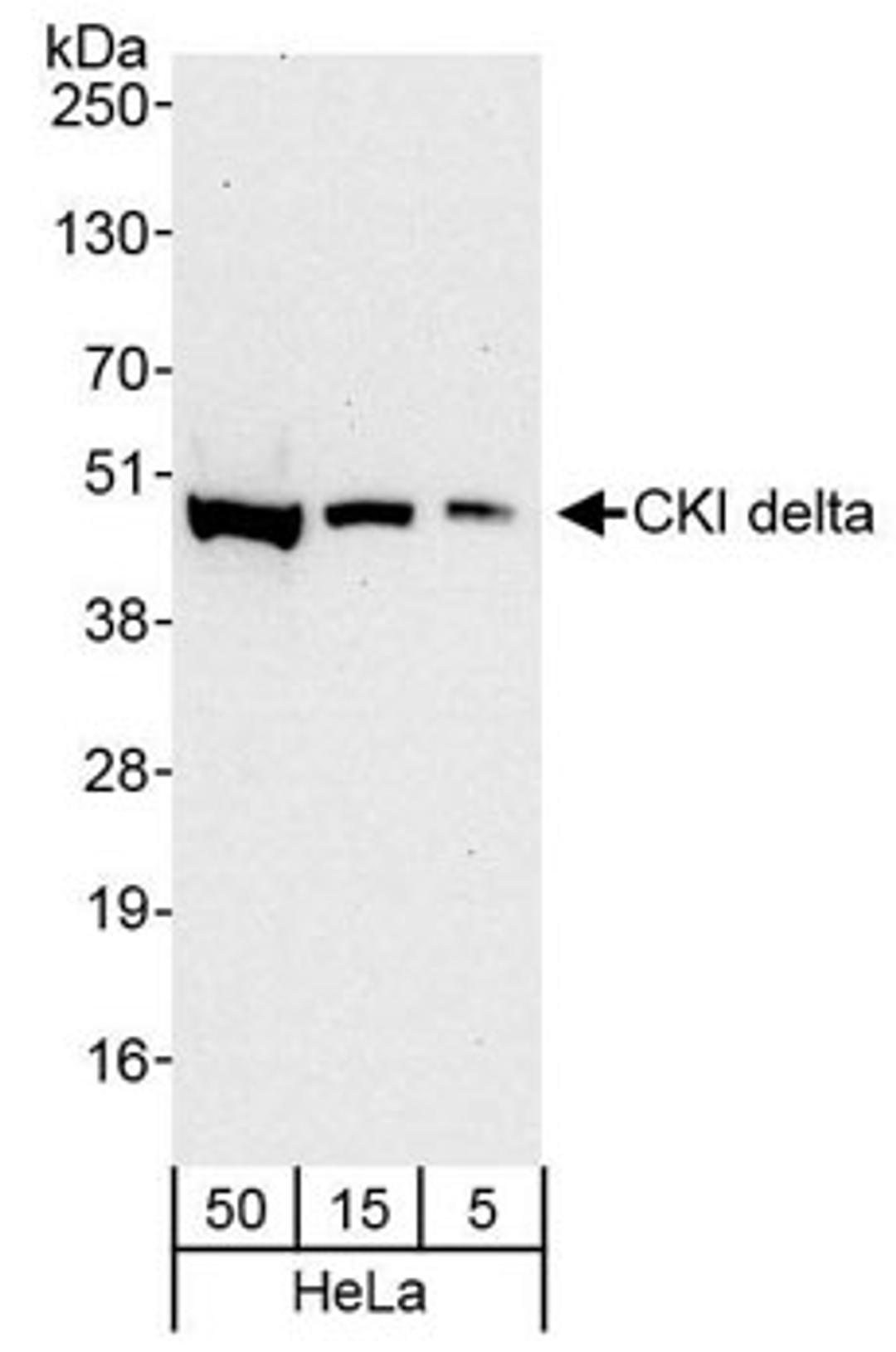 Detection of human CKI delta by western blot.