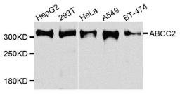 Western blot analysis of extracts of various cells using MRP 2 antibody