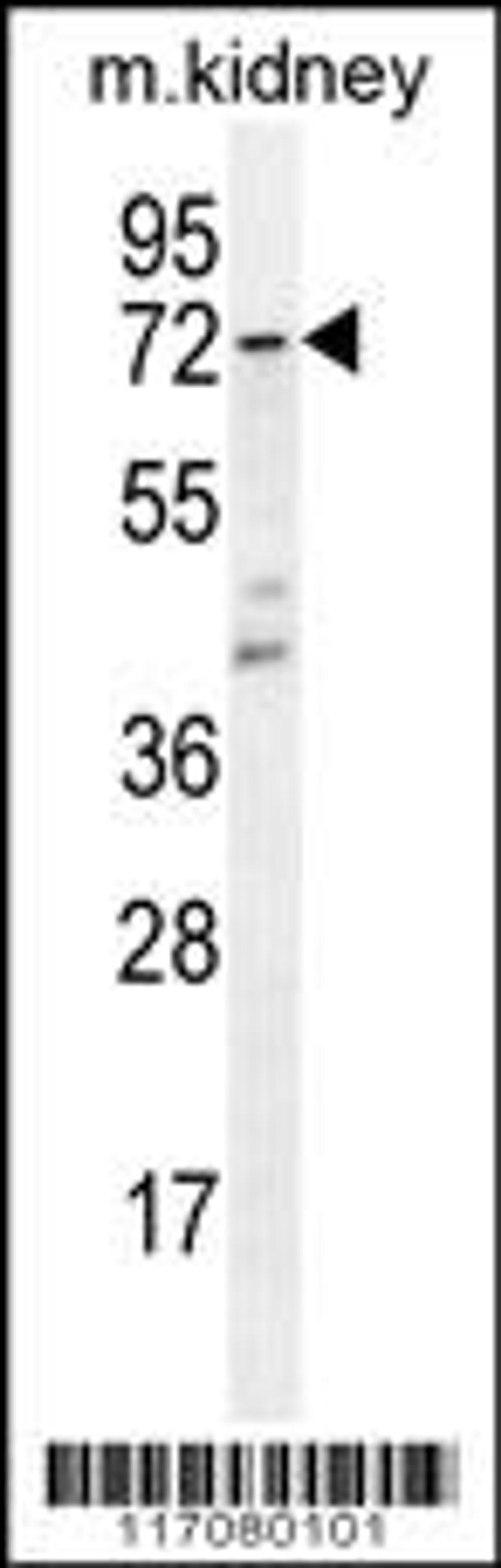 Western blot analysis in mouse kidney tissue lysates (35ug/lane).