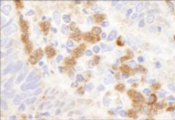 Detection of human G6PD by immunohistochemistry.