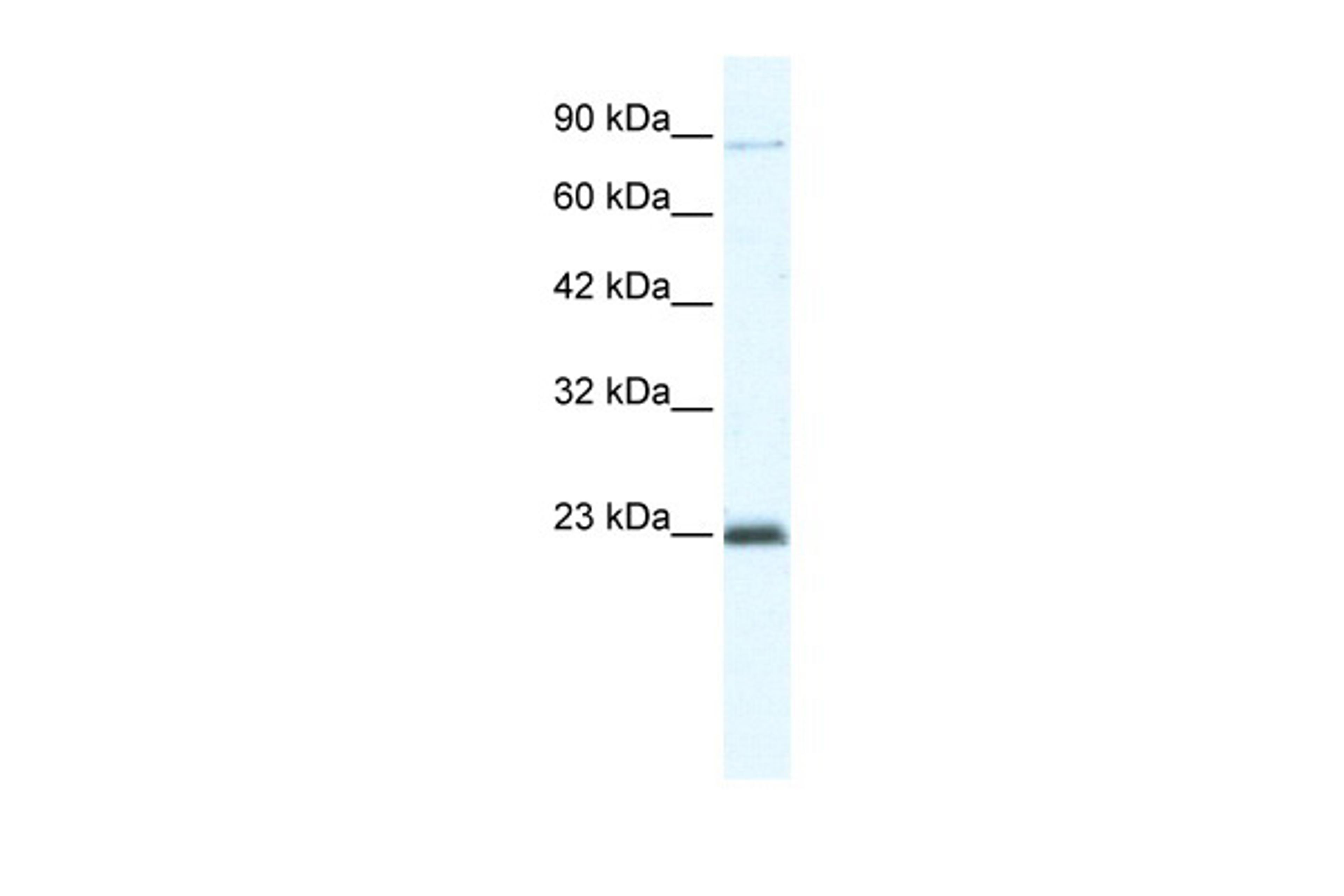 Antibody used in WB on Human Jurkat cells at 5.0 ug/ml.